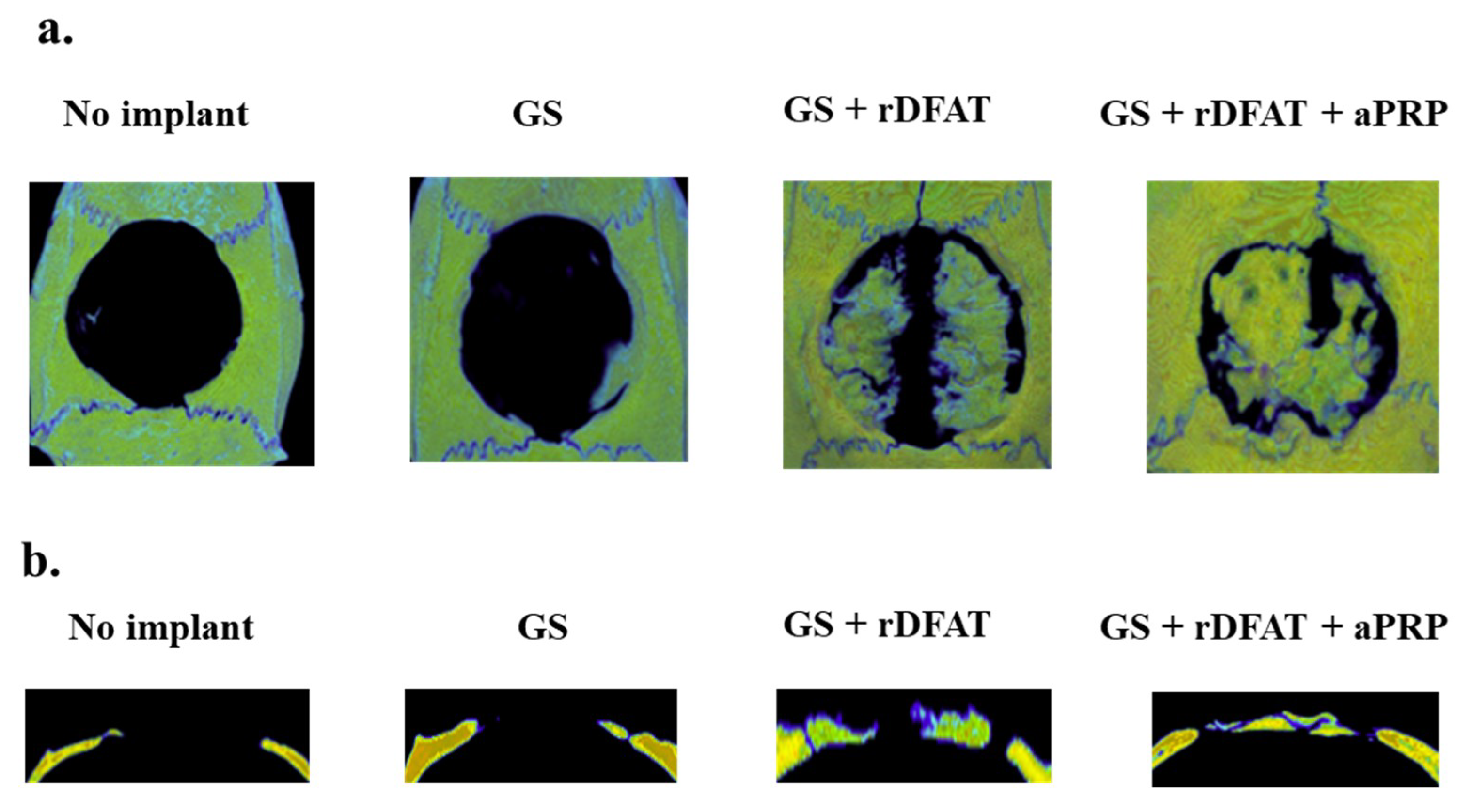 Materials 13 05097 g011