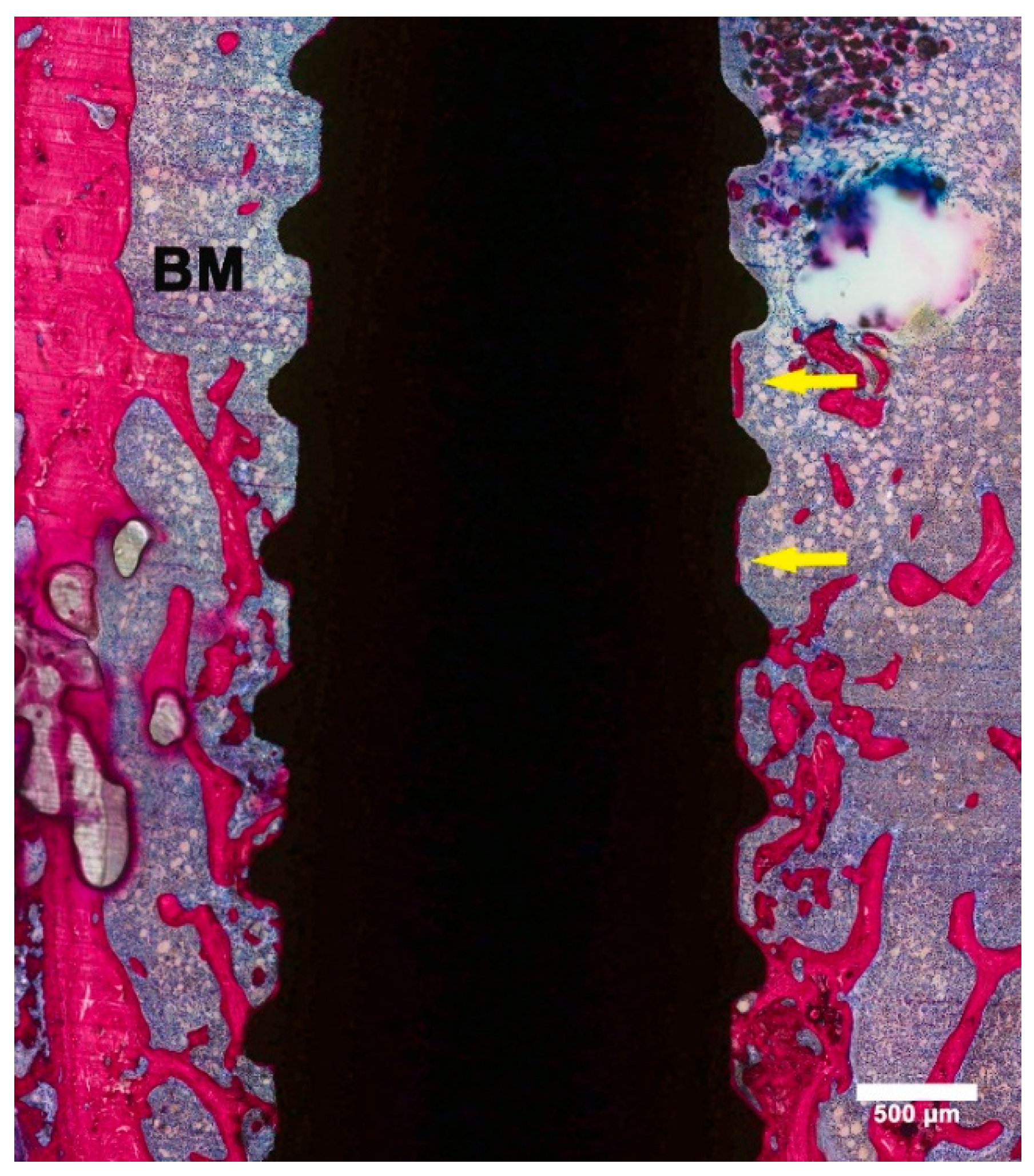 Materials 13 05248 g005 Materials 13 05248 g005