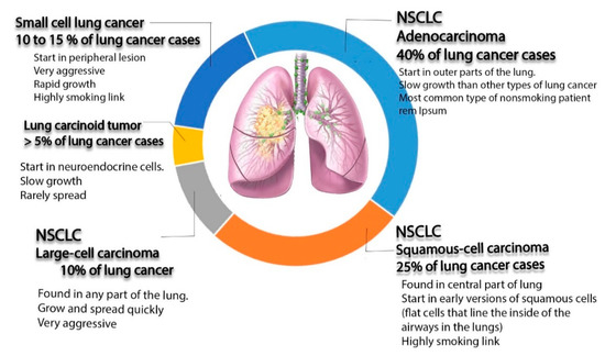 Materials Free Full Text Nano Targeted Therapies Made Of Lipids And Polymers Have Promising Strategy For The Treatment Of Lung Cancer Html