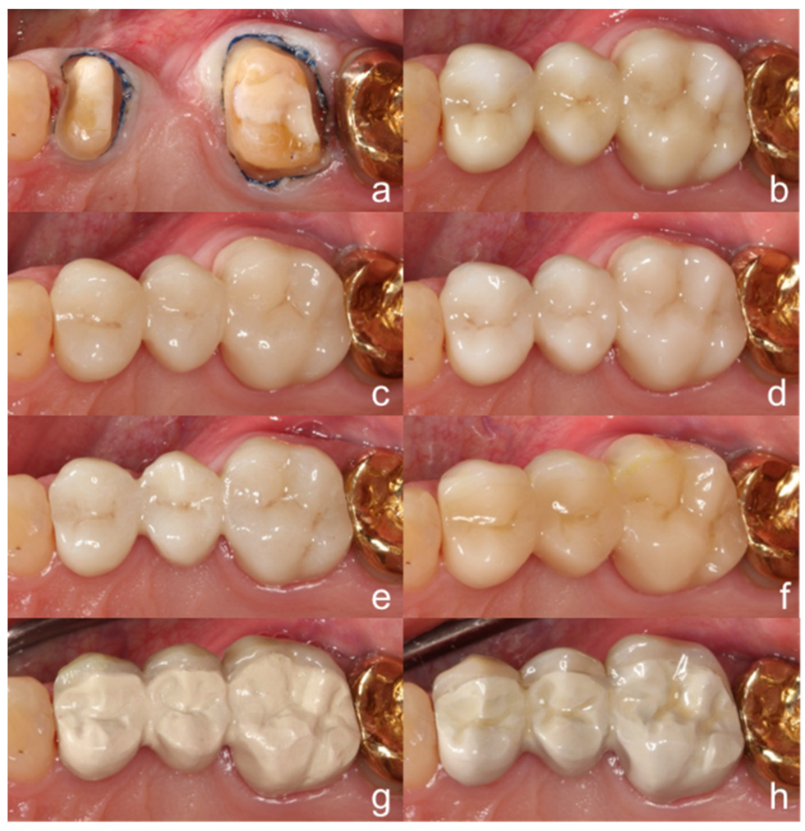 Materials 13 05588 g002