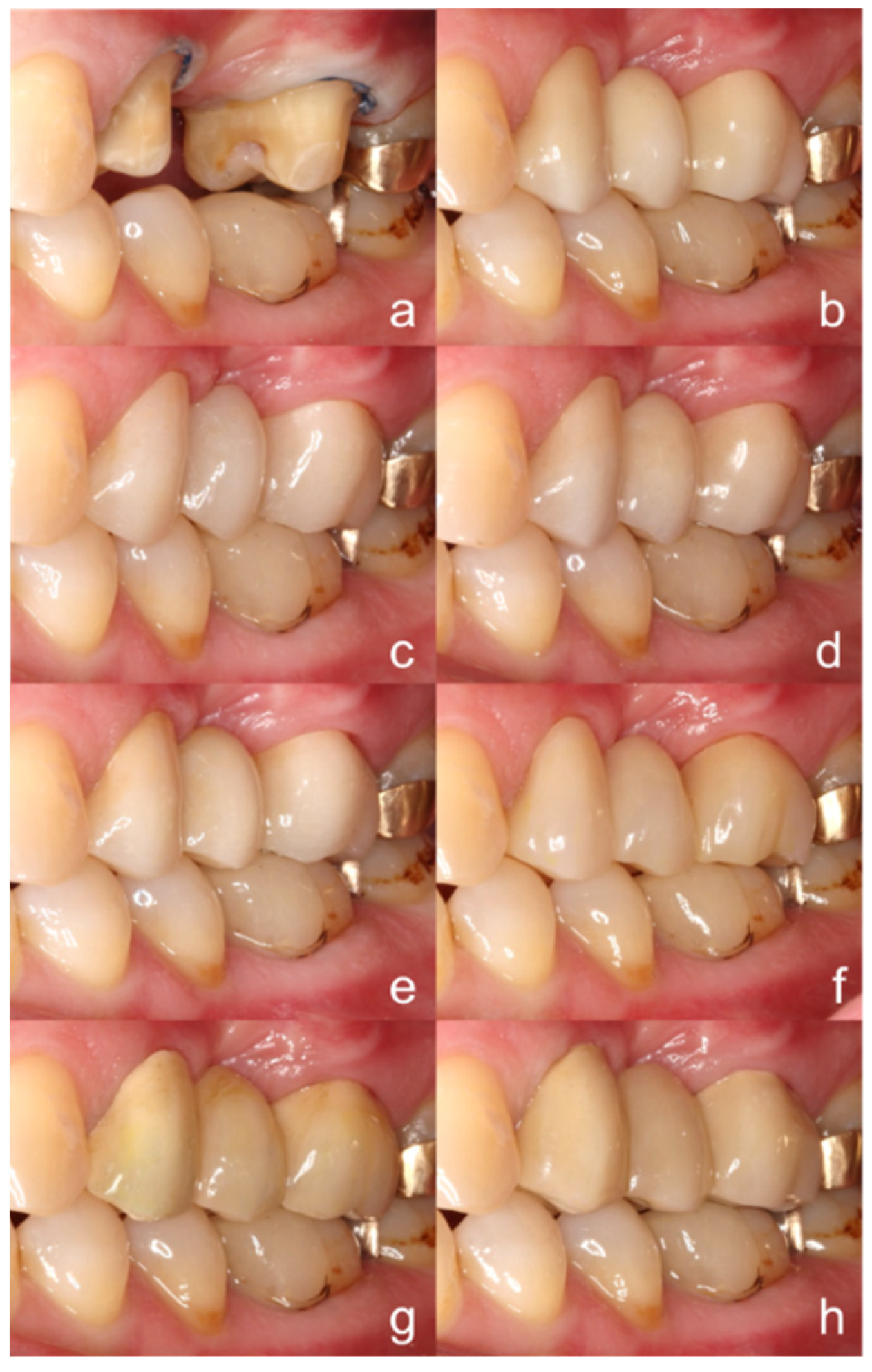 Materials 13 05588 g003