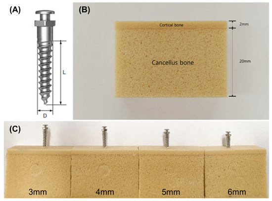 Effects of Intrabony Length and Cortical Bone Density on the