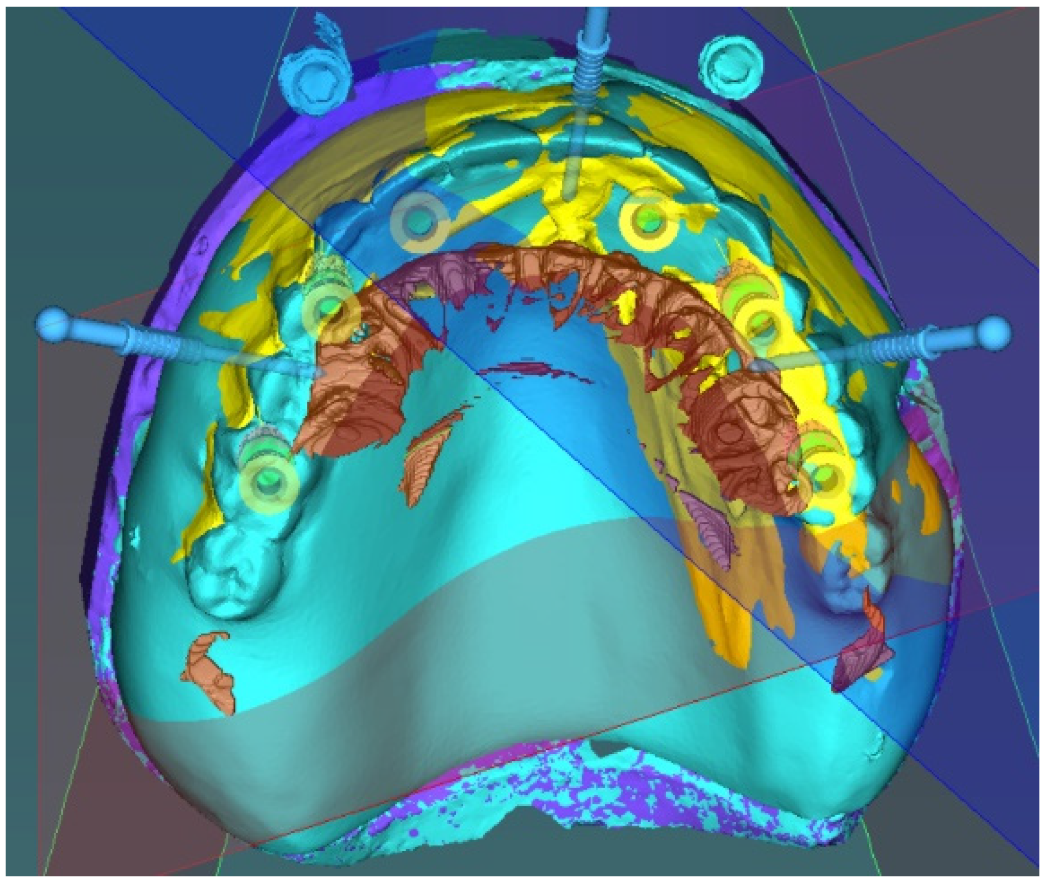 Materials 13 05759 g001 Materials 13 05759 g001