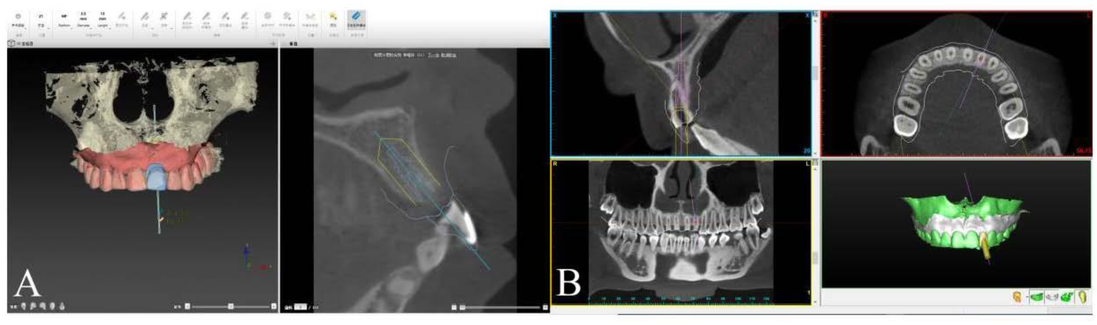 Materials 14 00026 g001 Materials 14 00026 g001