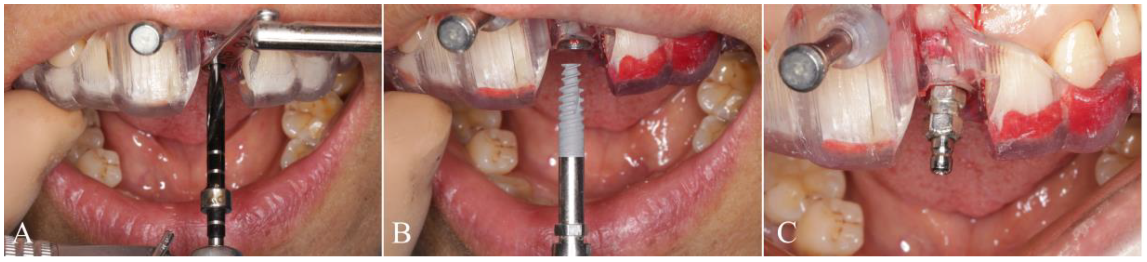 Materials 14 00026 g003 Materials 14 00026 g003