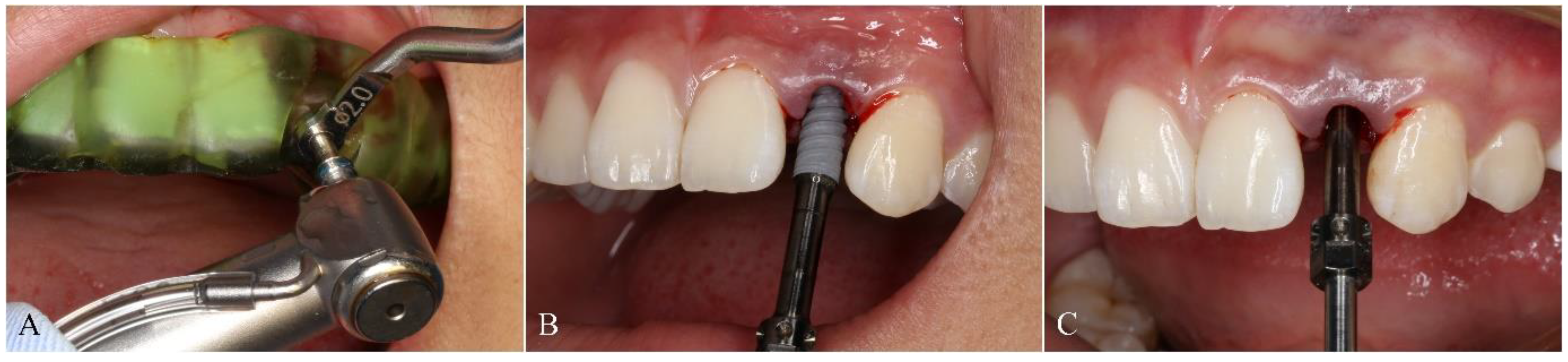 Materials 14 00026 g004 Materials 14 00026 g004