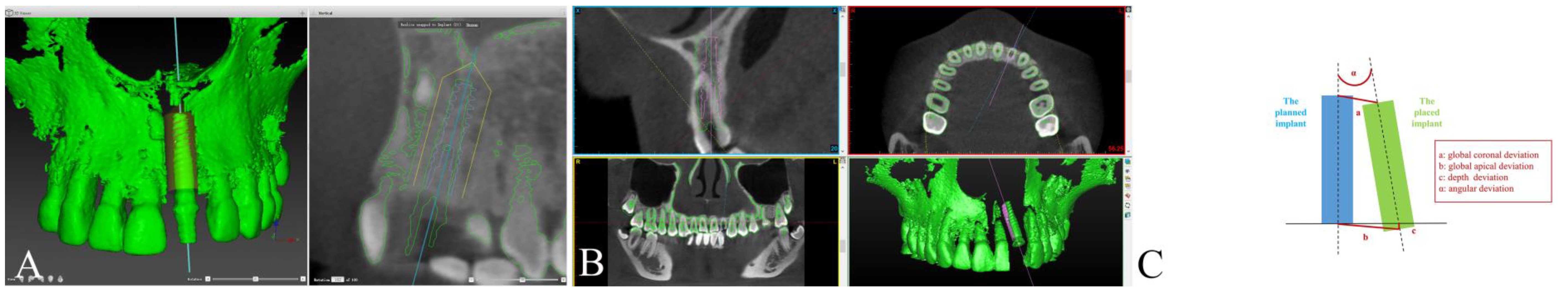 Materials 14 00026 g005 Materials 14 00026 g005