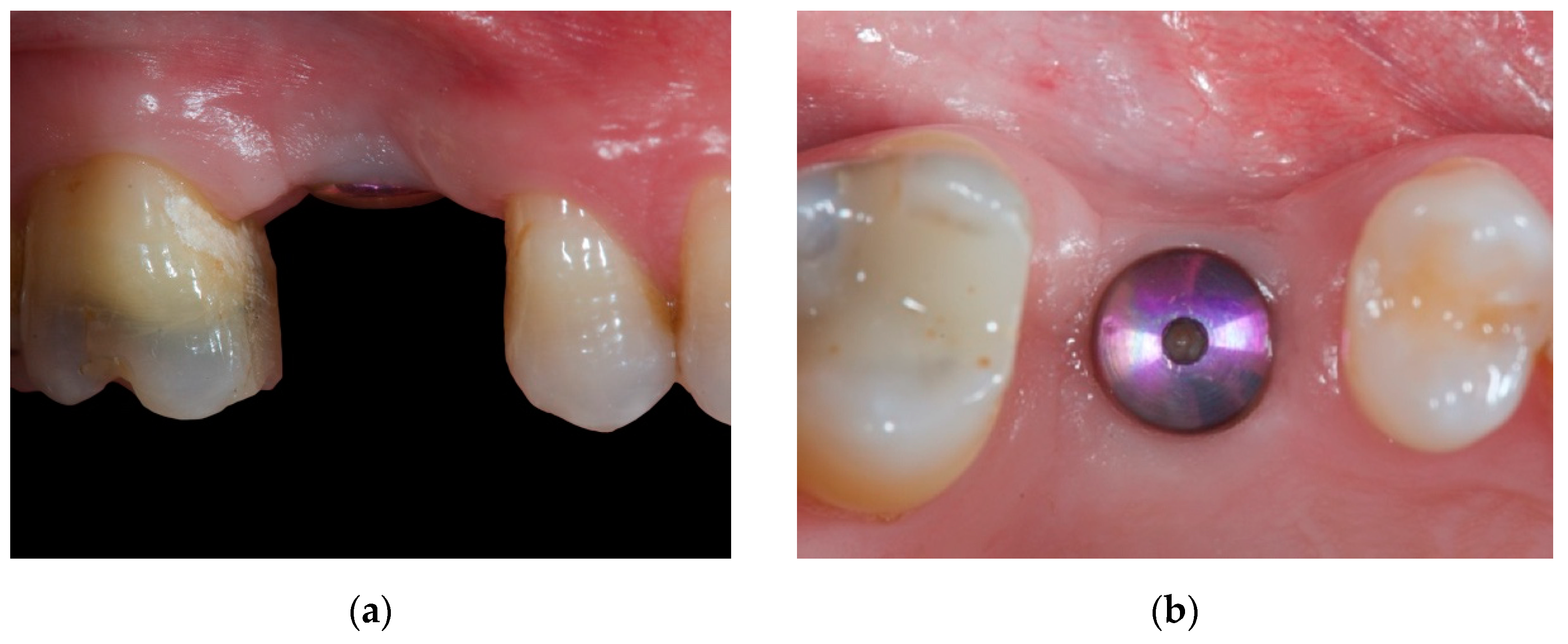 Materials 14 00093 g001