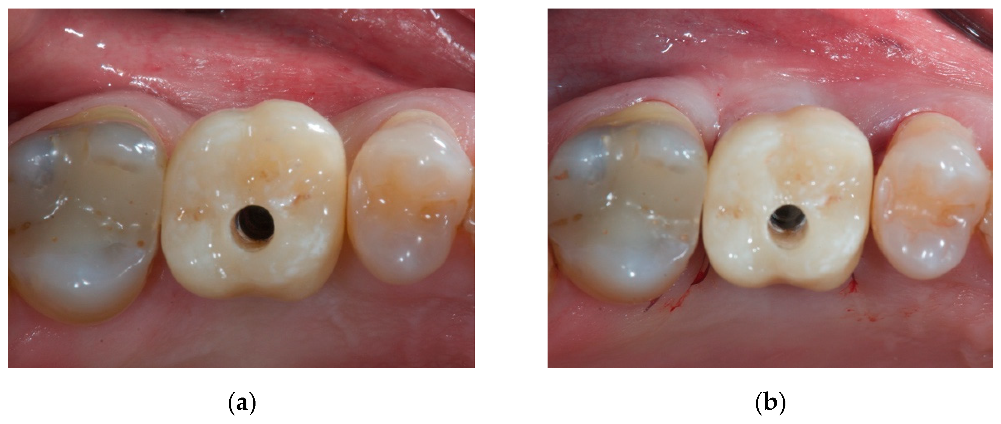 Materials 14 00093 g004