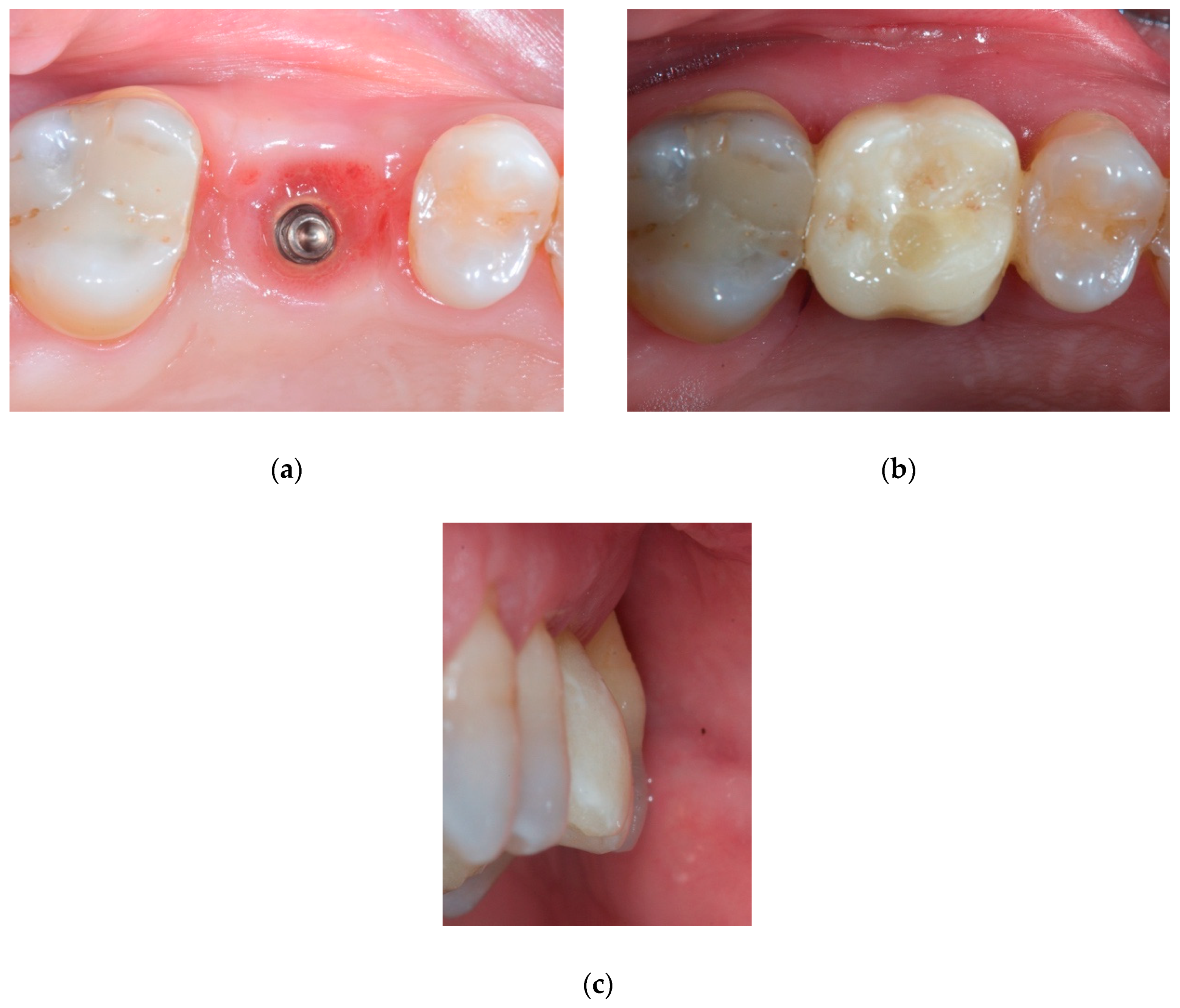 Materials 14 00093 g005
