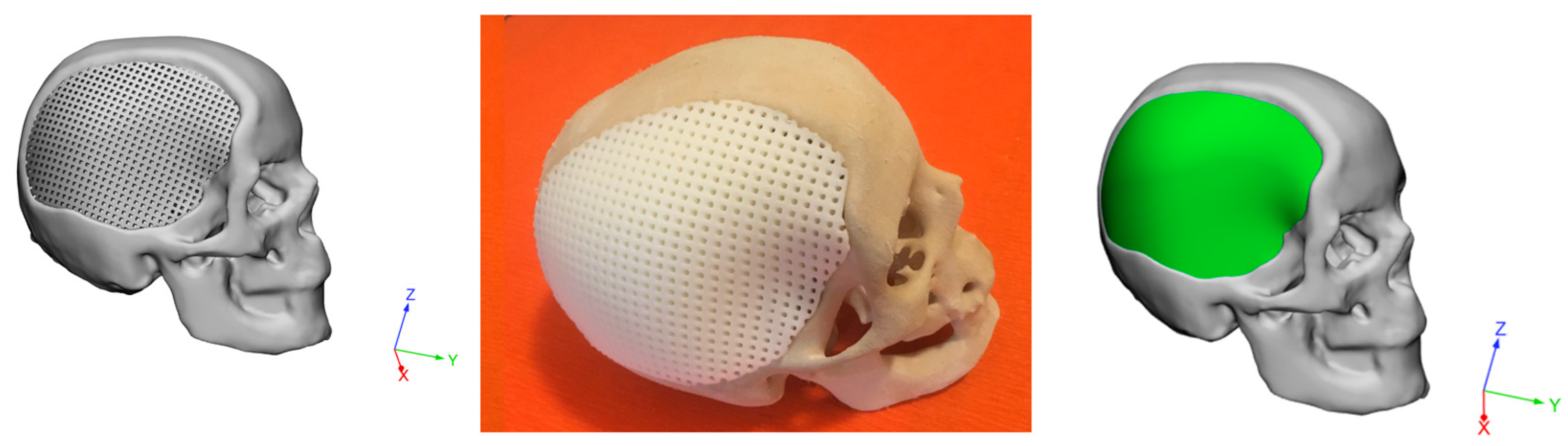 Materials 14 00181 g010 Materials 14 00181 g010