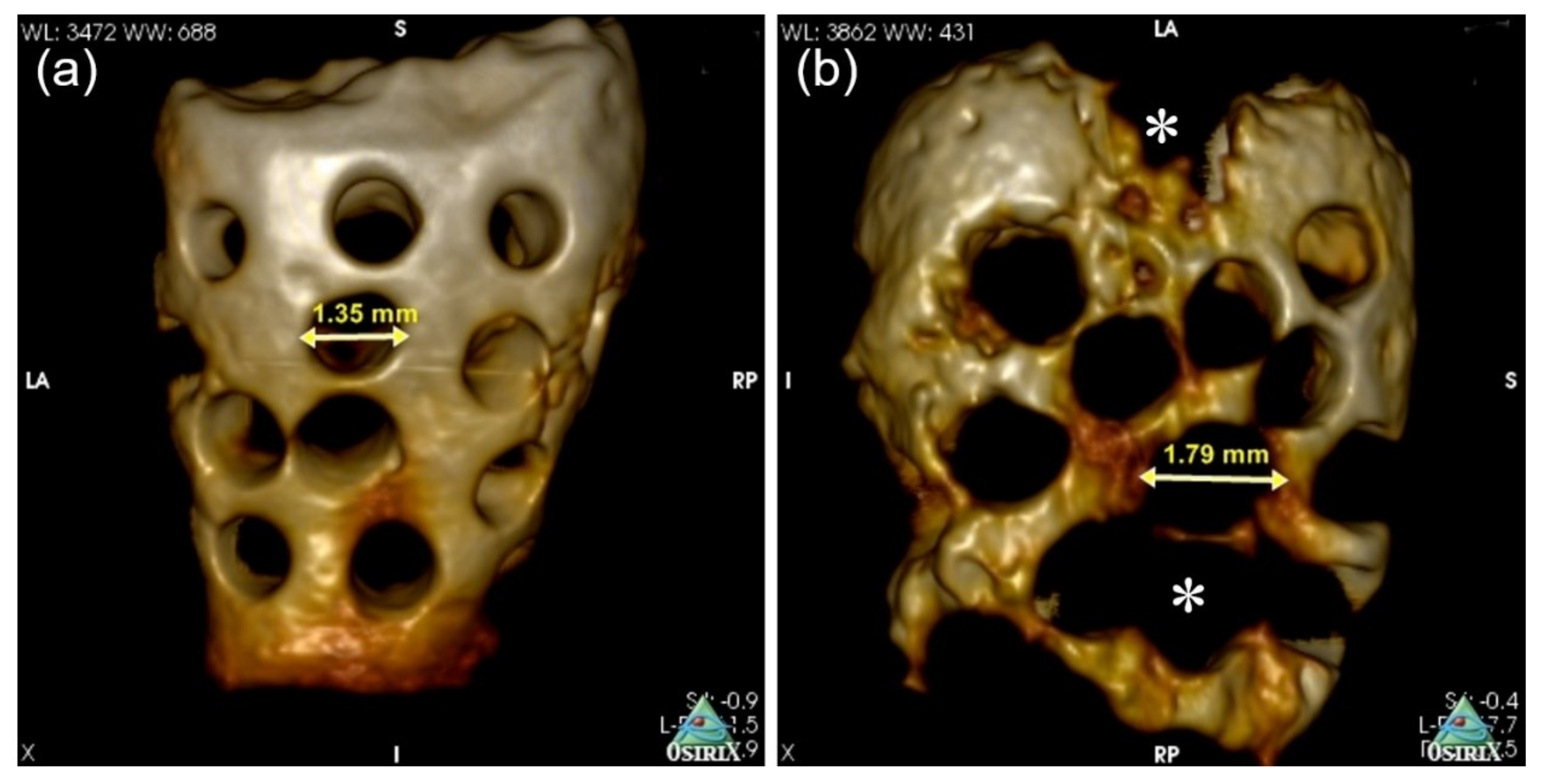 Materials 14 00223 g005 Materials 14 00223 g005