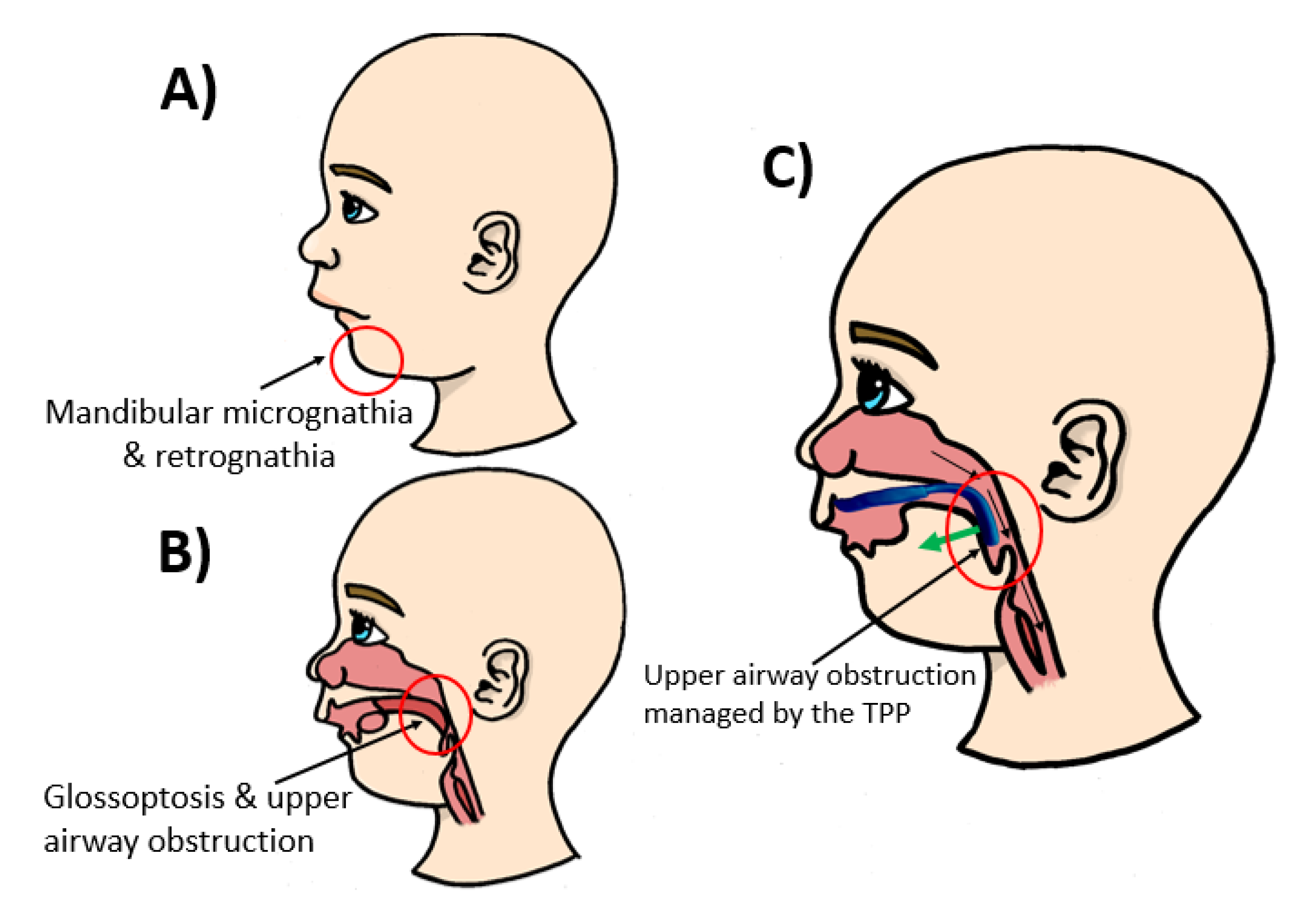 Materials 14 00344 g001