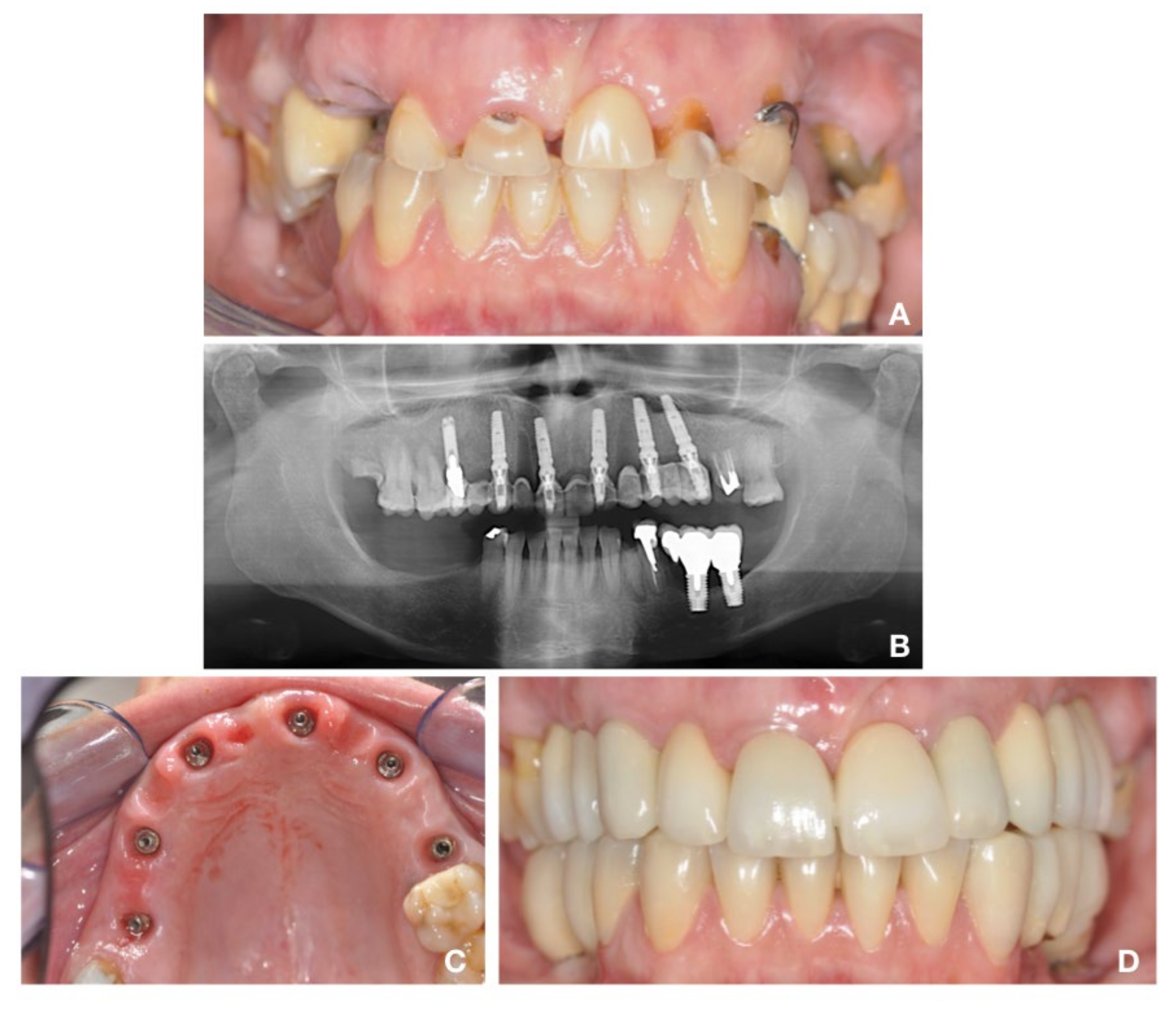 Materials 14 00387 g002 Materials 14 00387 g002