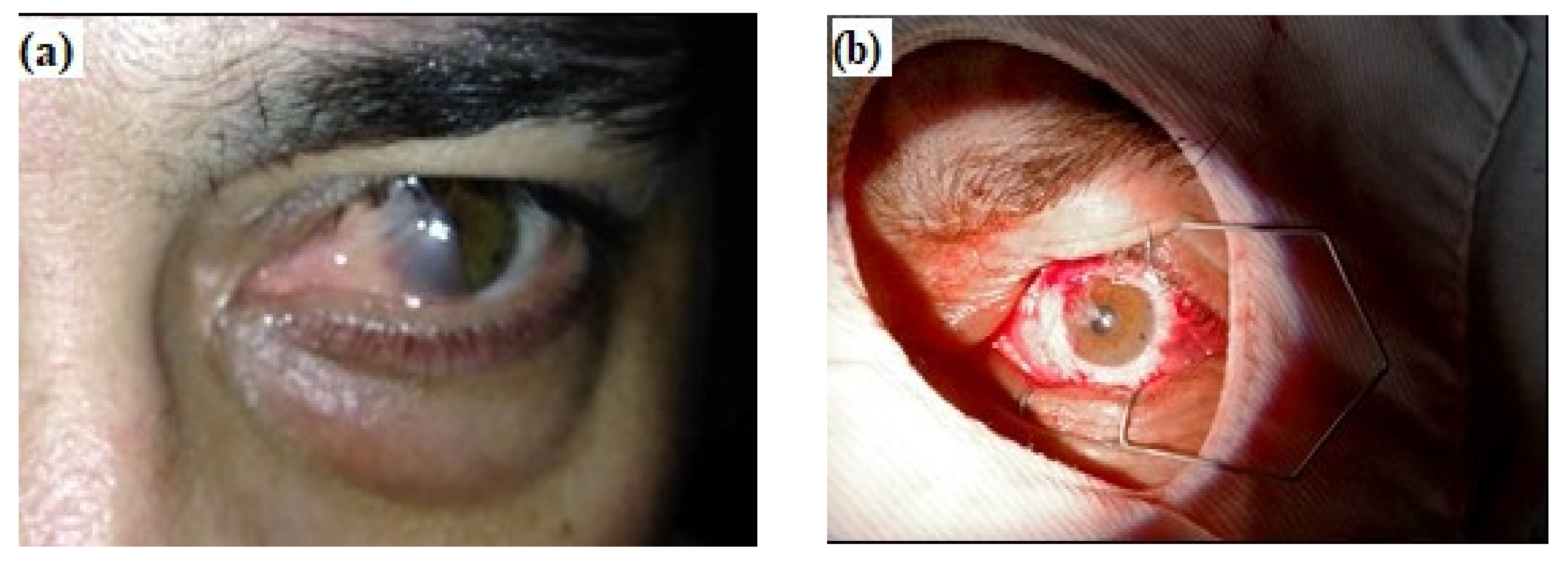 Materials 14 00863 g009a