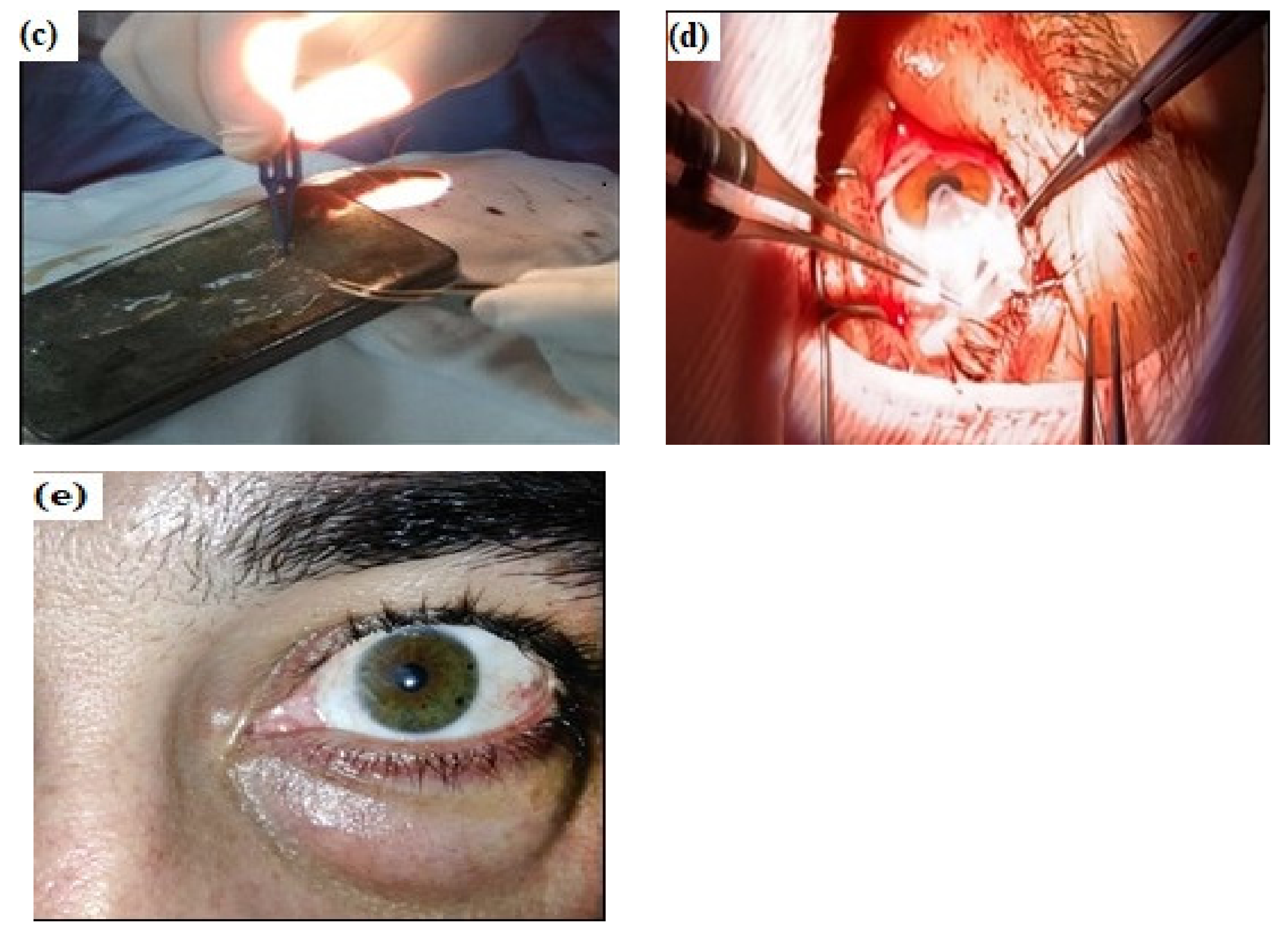 Materials 14 00863 g009b