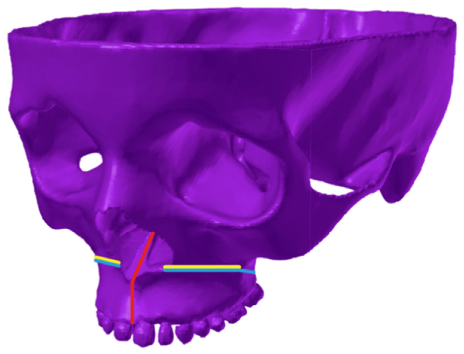 Materials 14 01152 g004 Materials 14 01152 g004