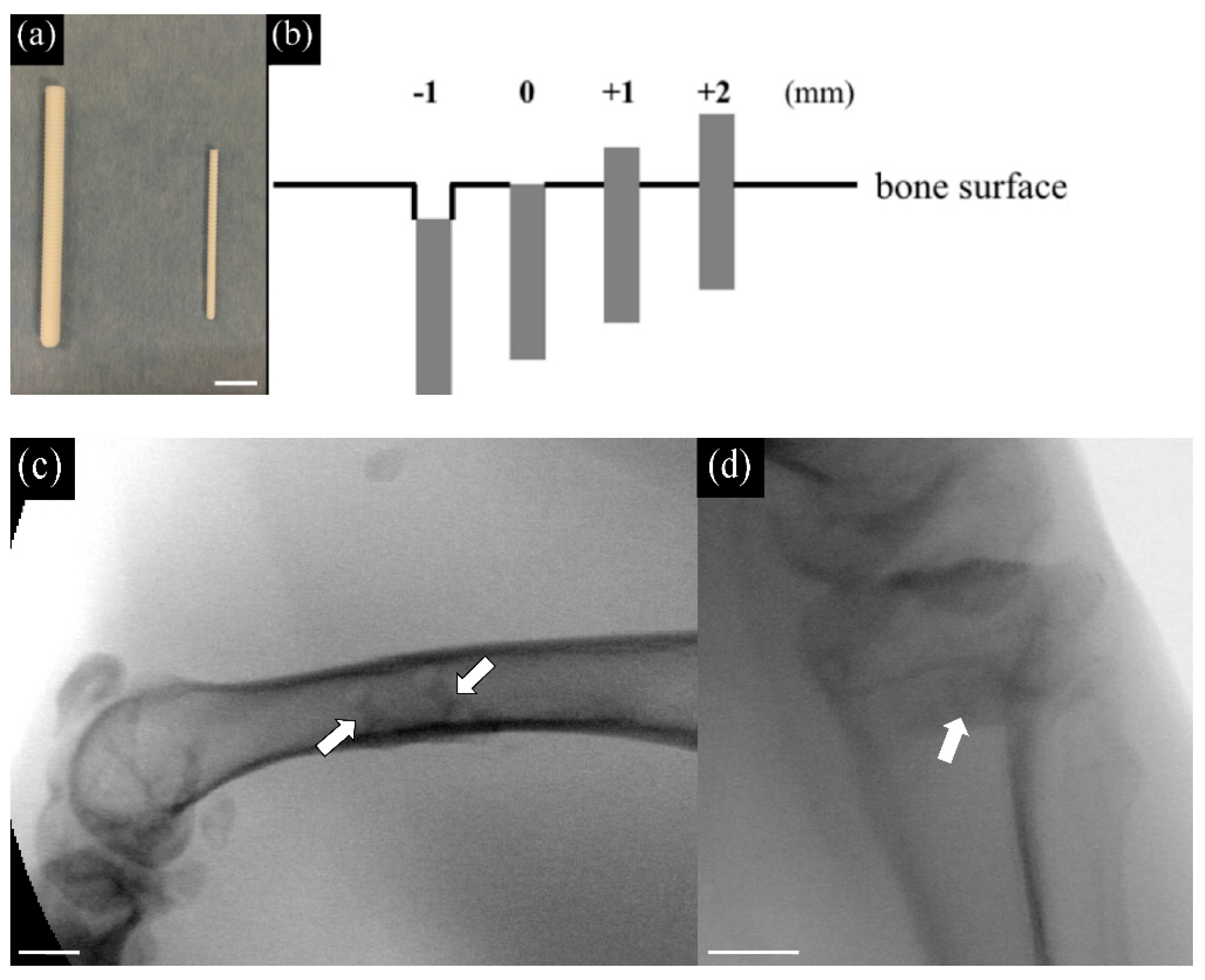 Materials Free Full Text Bone Coverage Around Hydroxyapatite Poly L Lactide Composite Is Determined According To Depth From Cortical Bone Surface In Rabbits Html