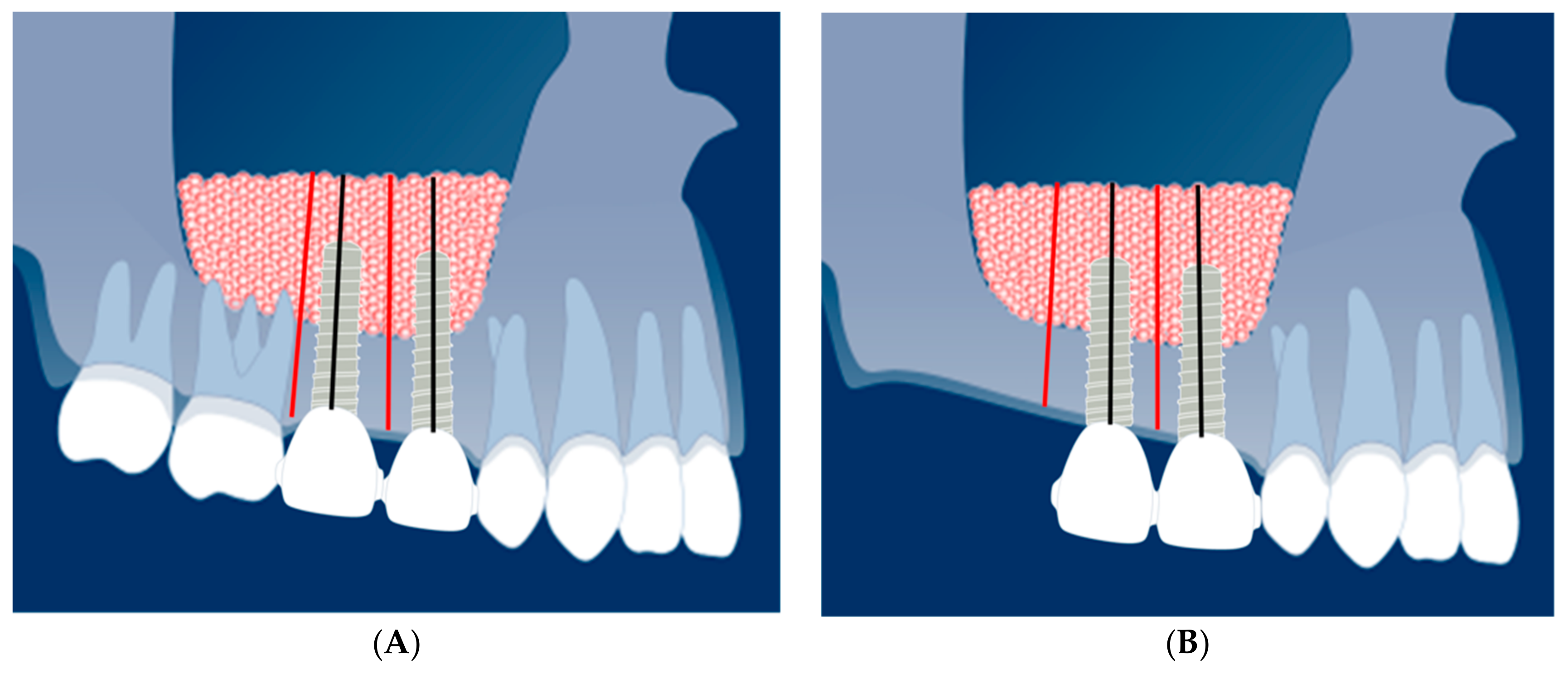 Materials 14 01471 g001