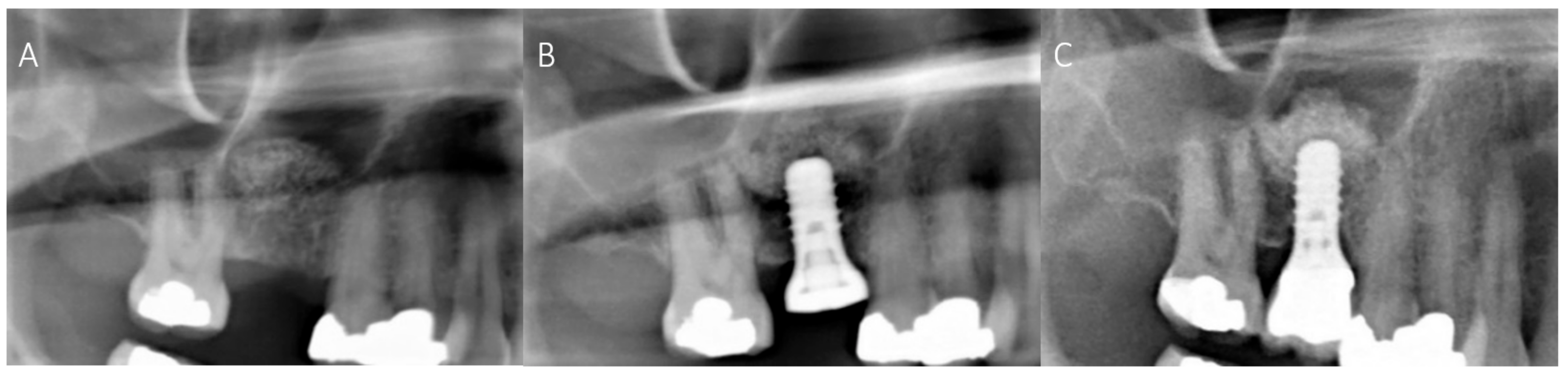 Materials 14 01471 g003