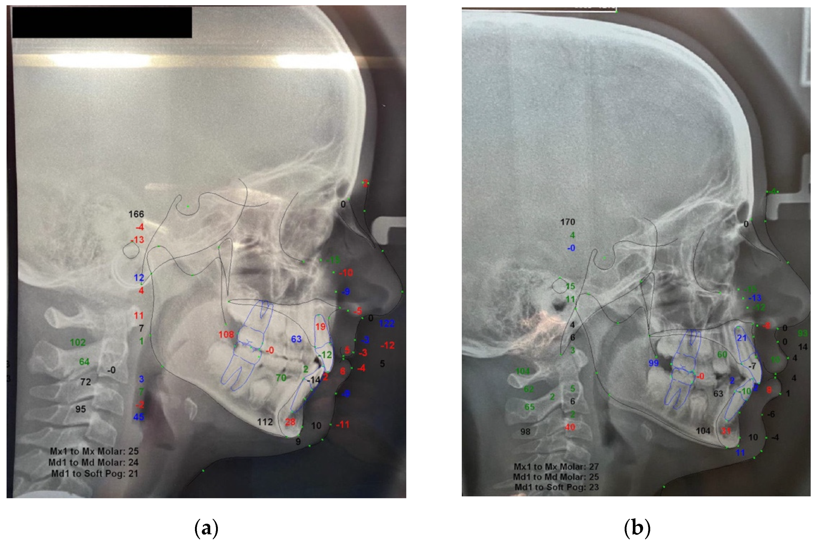 Materials 14 01695 g002