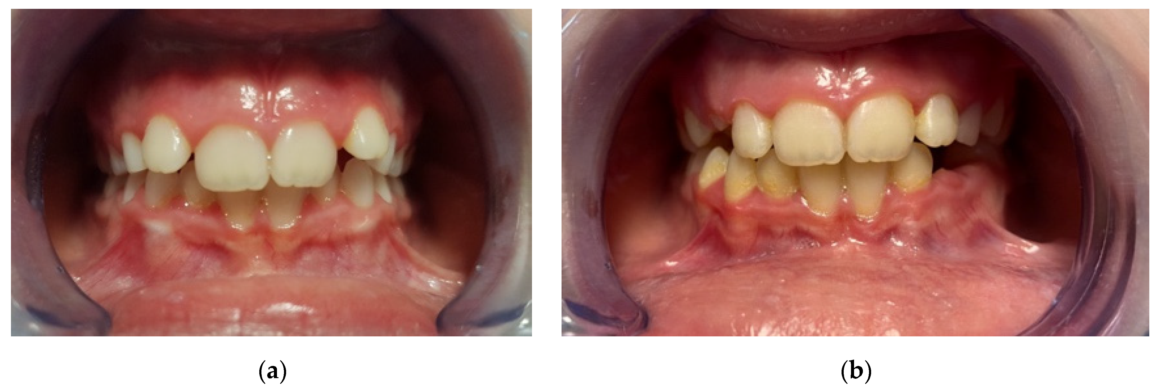 Materials 14 01695 g003