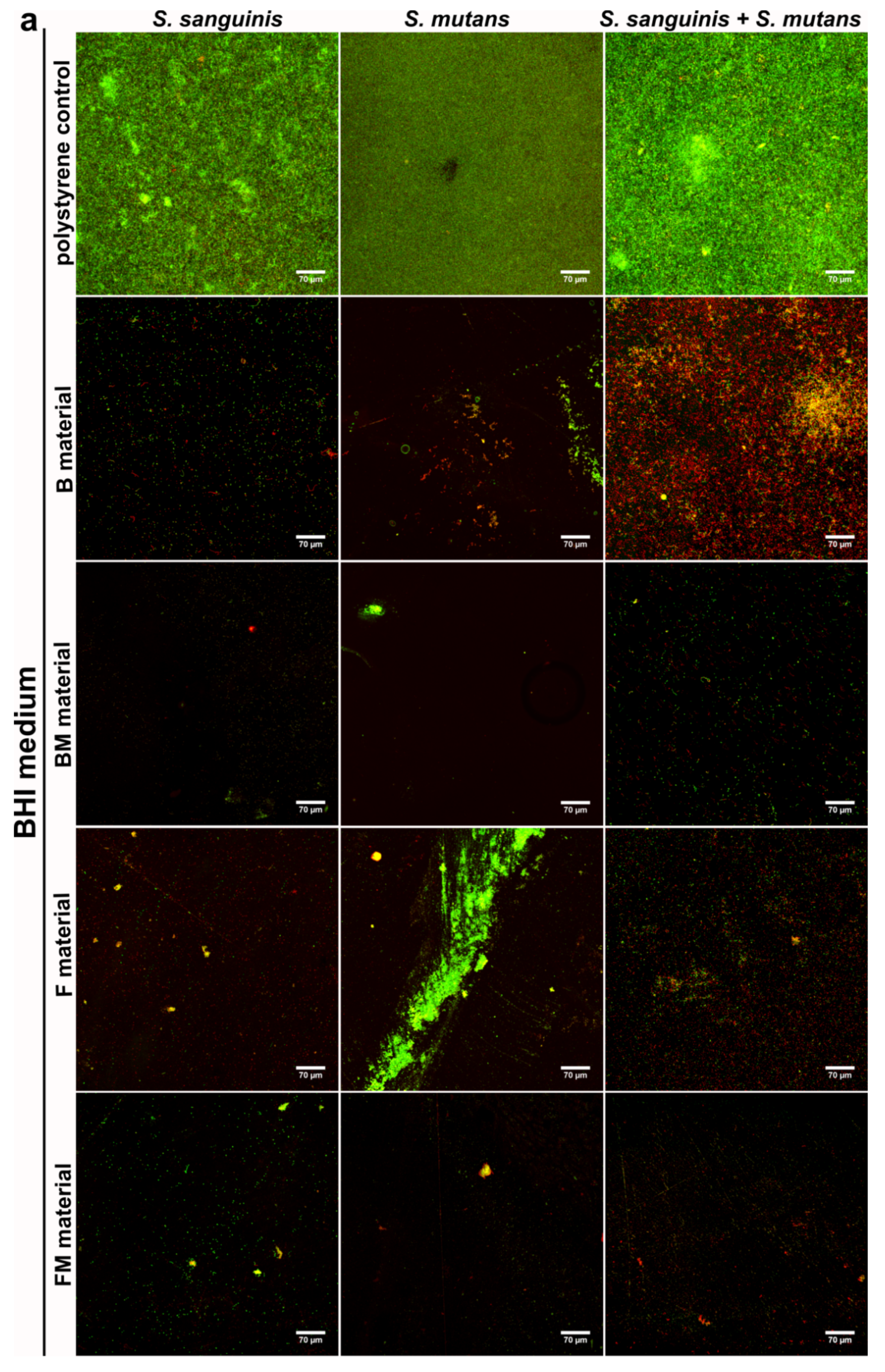 Materials 14 01704 g004a Materials 14 01704 g004a