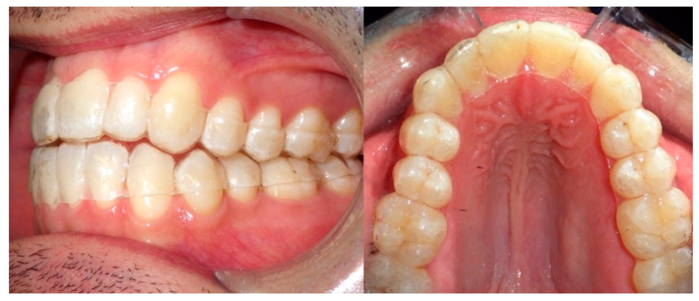 Materials 14 01799 g003 Materials 14 01799 g003