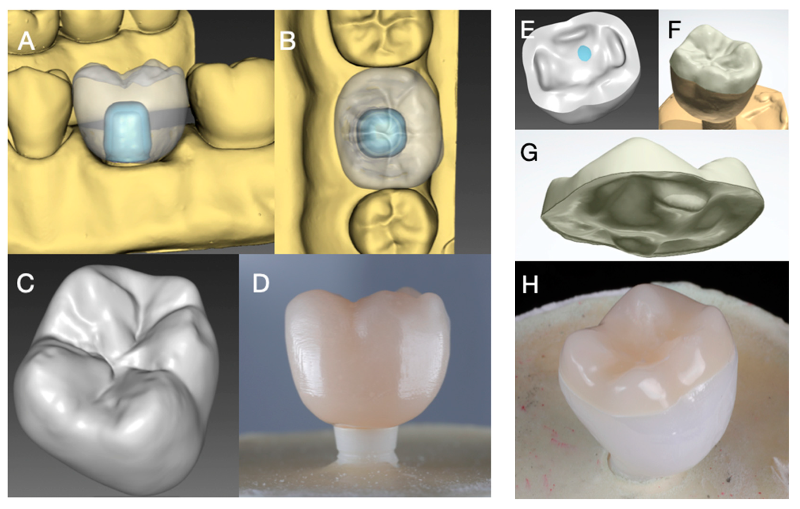 Materials 14 01990 g002 Materials 14 01990 g002