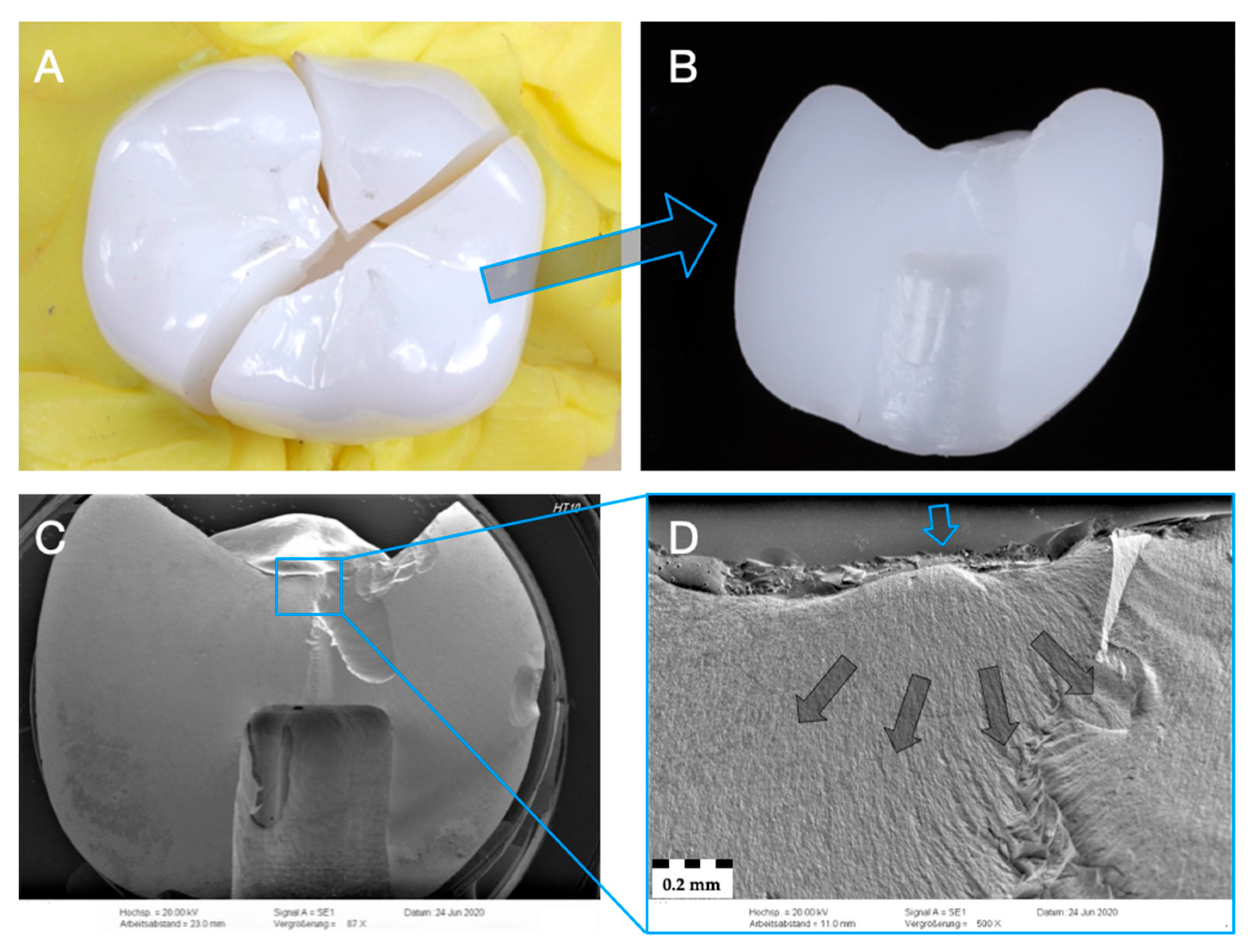 Materials 14 01990 g005 Materials 14 01990 g005
