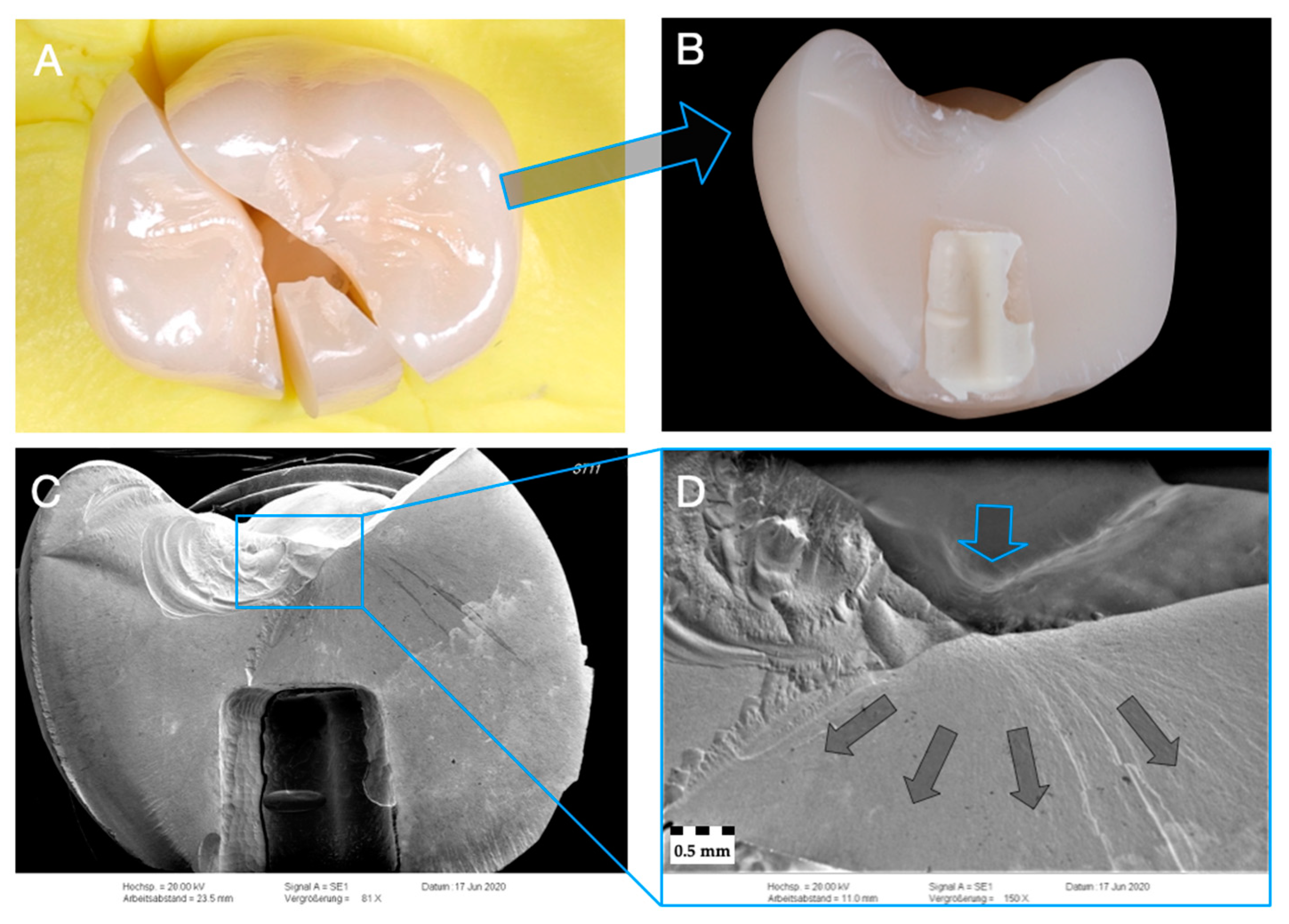 Materials 14 01990 g006 Materials 14 01990 g006