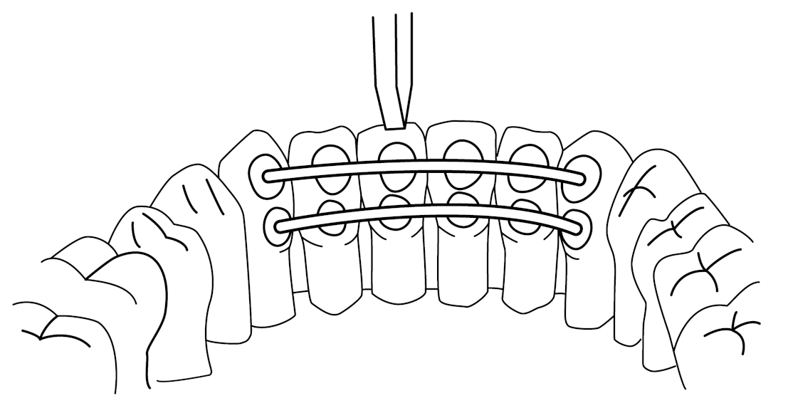 Materials 14 02319 g005 Materials 14 02319 g005
