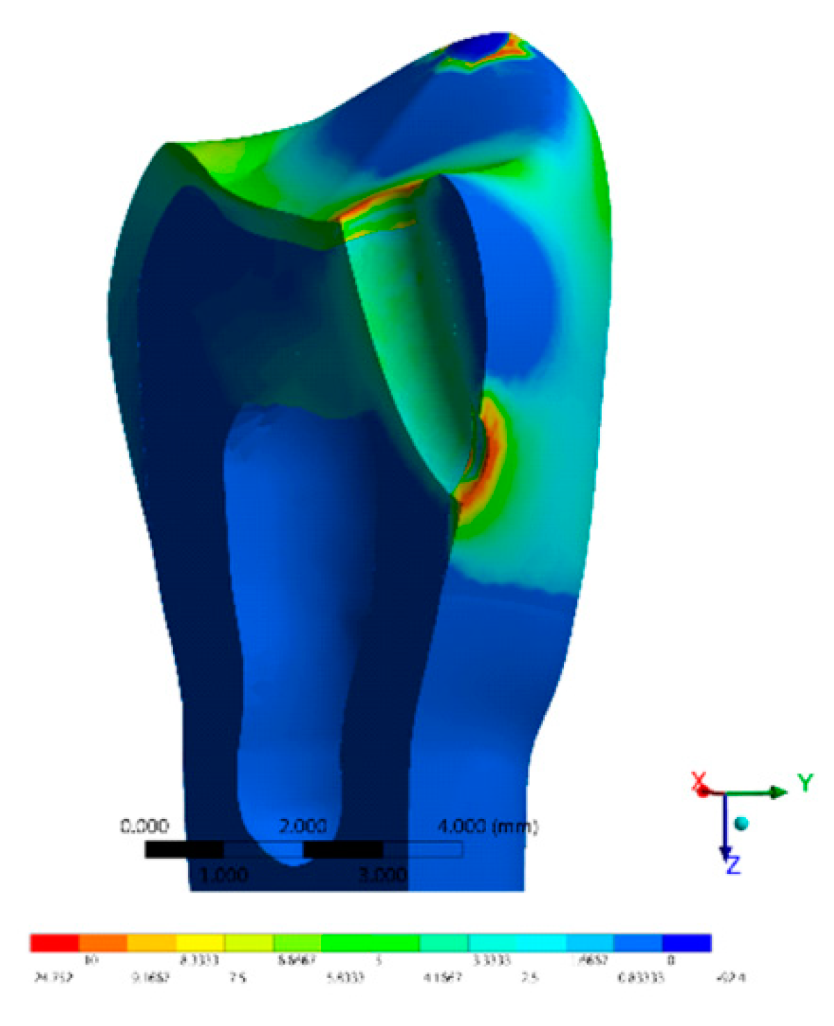 Materials 14 02366 g008