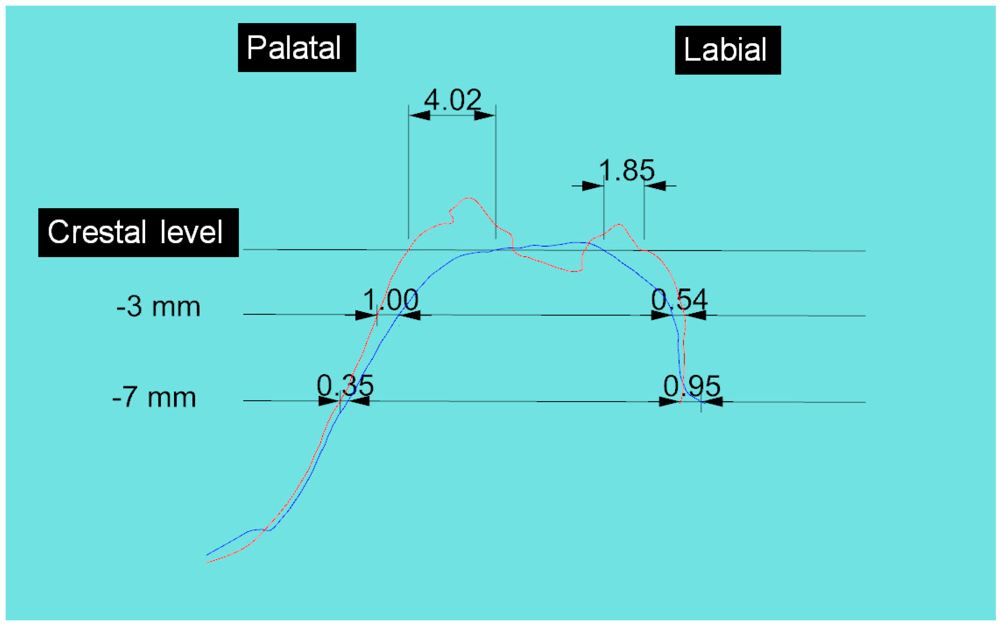 Materials 14 02473 g008 Materials 14 02473 g008