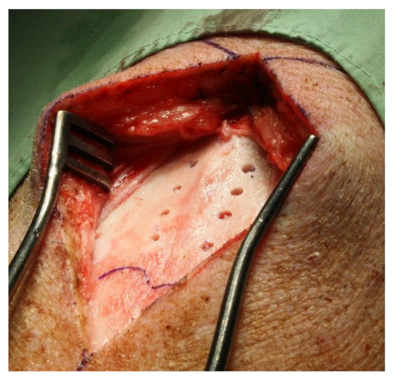 Materials 14 02645 g002 Materials 14 02645 g002