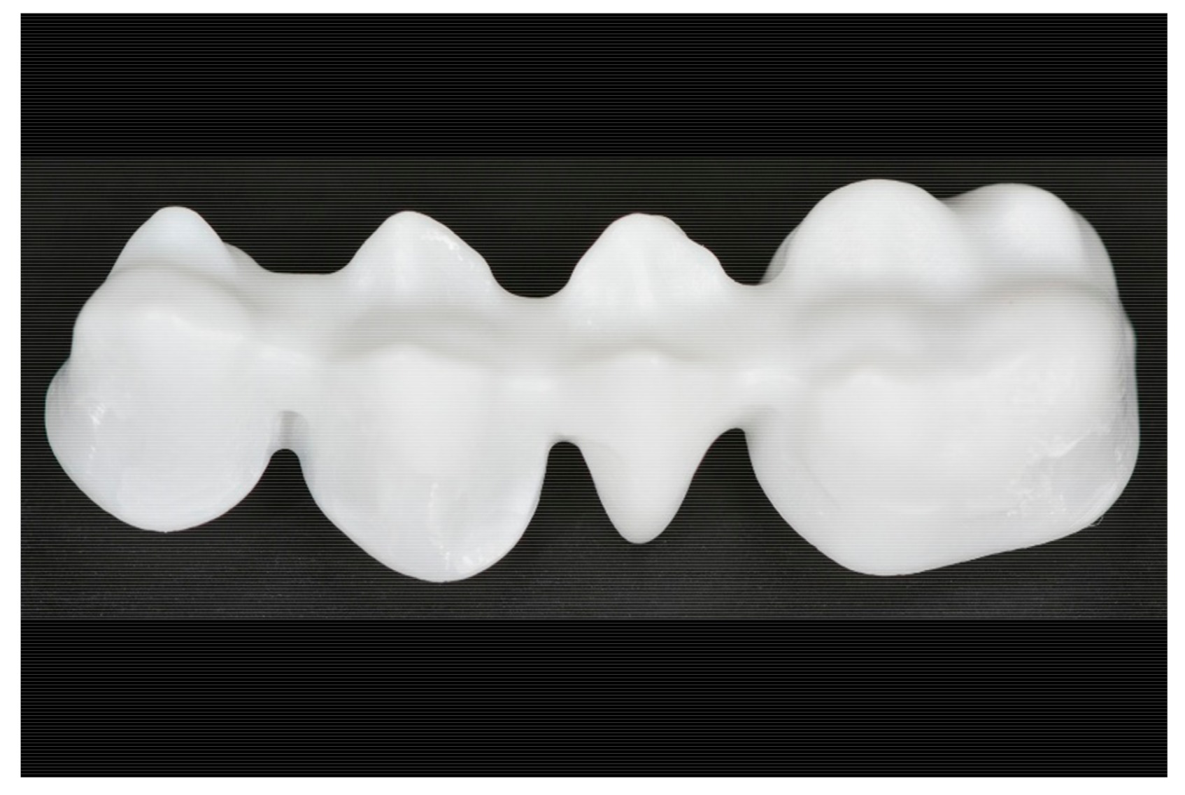 Materials Free FullText Marginal and Internal Precision of Zirconia FourUnit Fixed Partial