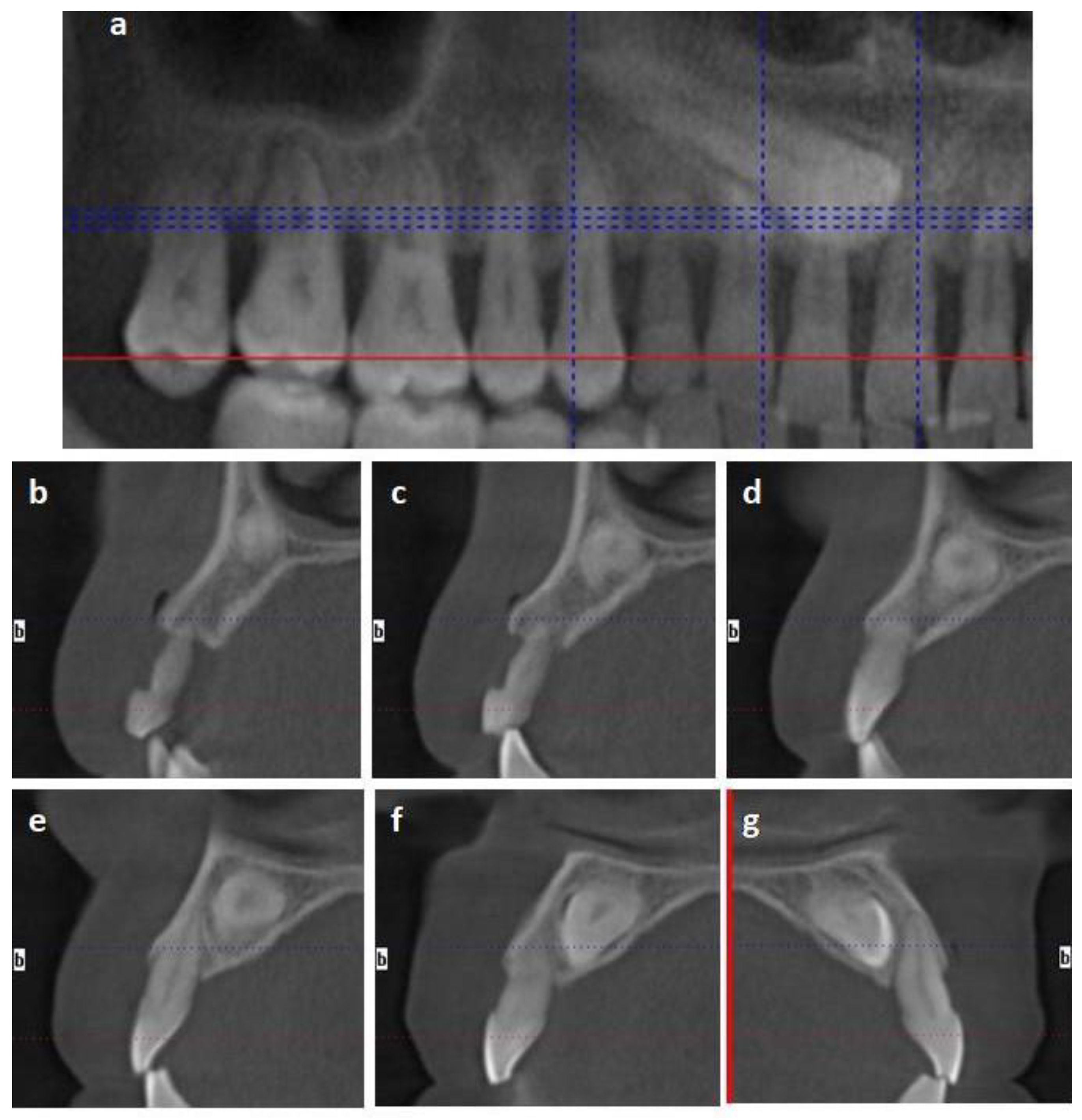 Materials 14 02757 g001 Materials 14 02757 g001