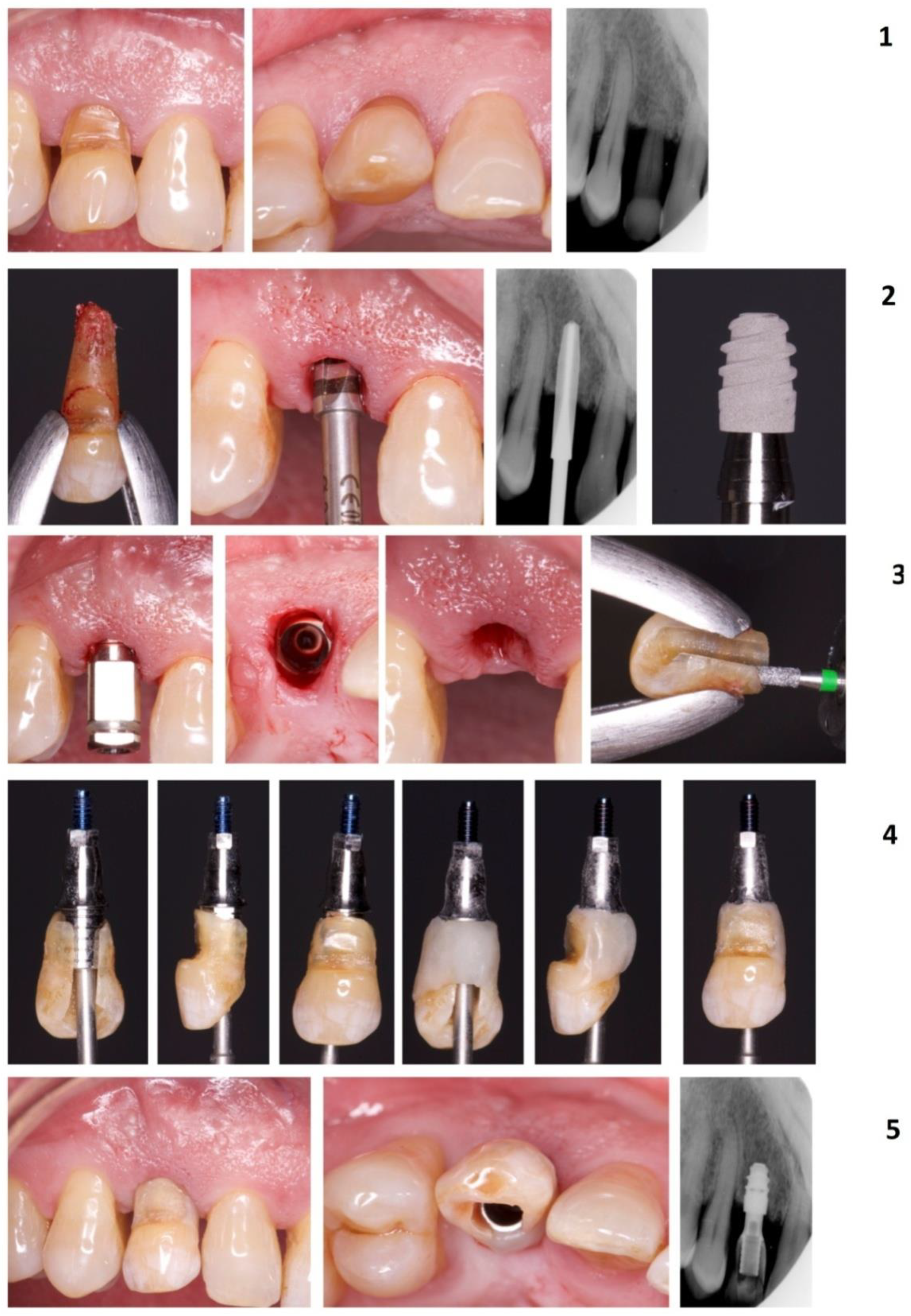 Materials 14 02757 g003 Materials 14 02757 g003