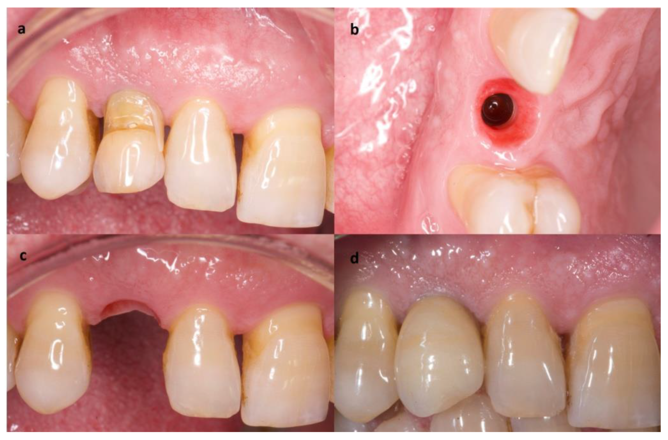 Materials 14 02757 g004 Materials 14 02757 g004