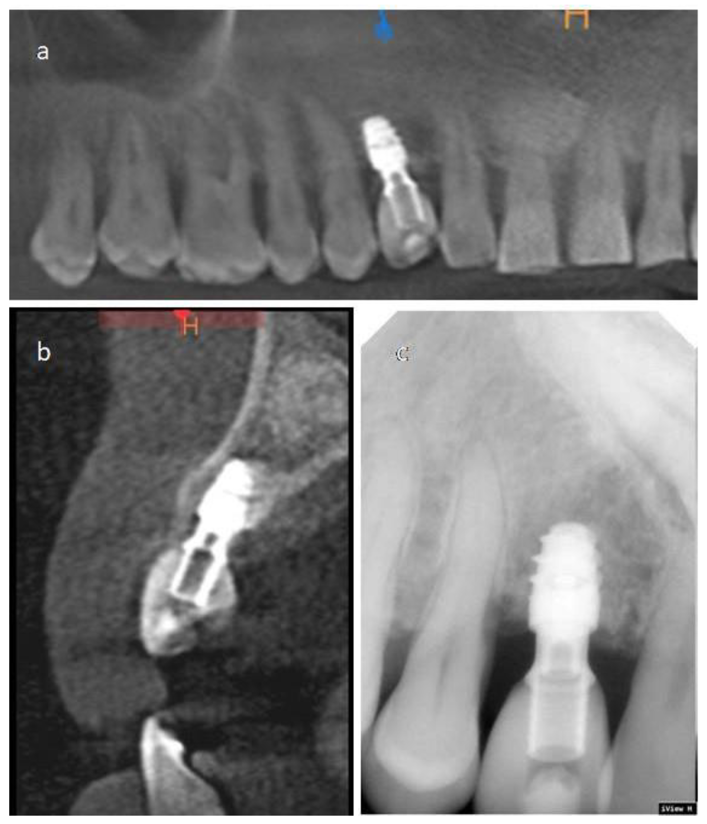 Materials 14 02757 g005 Materials 14 02757 g005