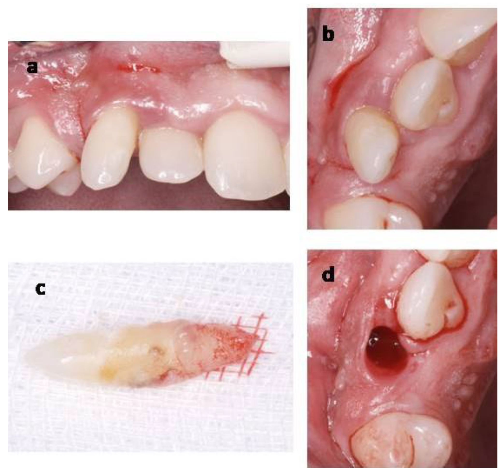 Materials 14 02757 g006 Materials 14 02757 g006