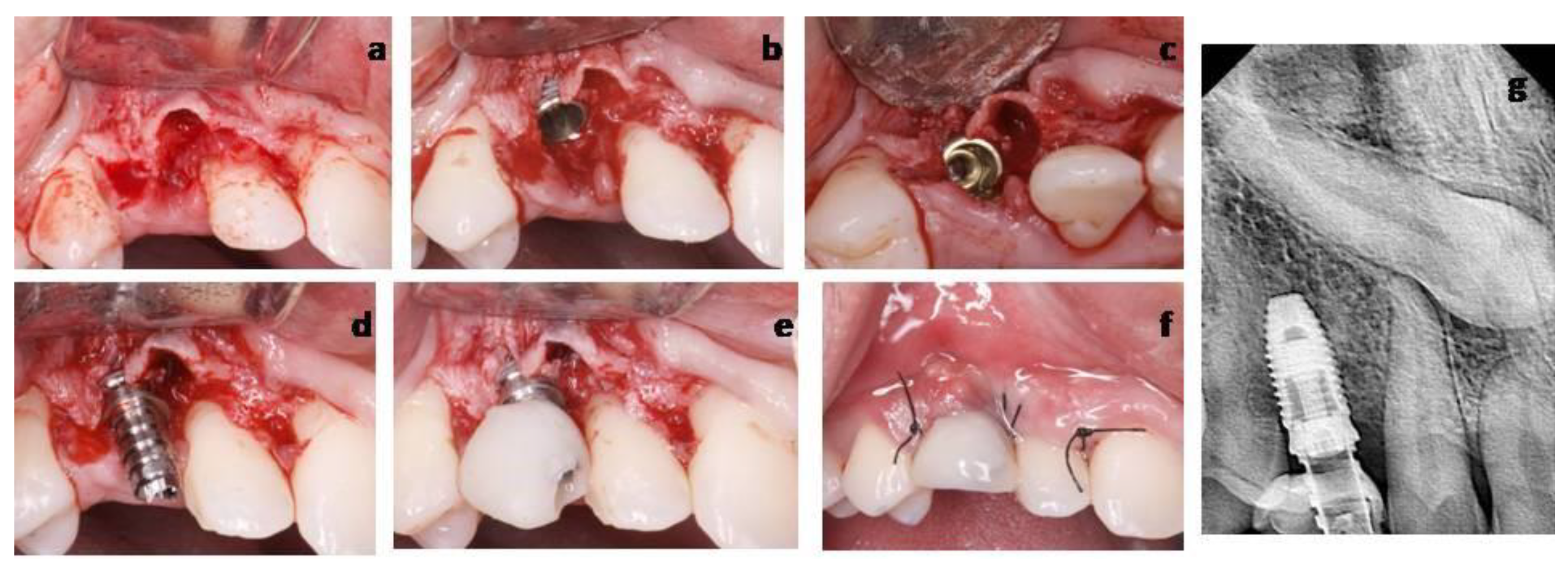 Materials 14 02757 g007 Materials 14 02757 g007