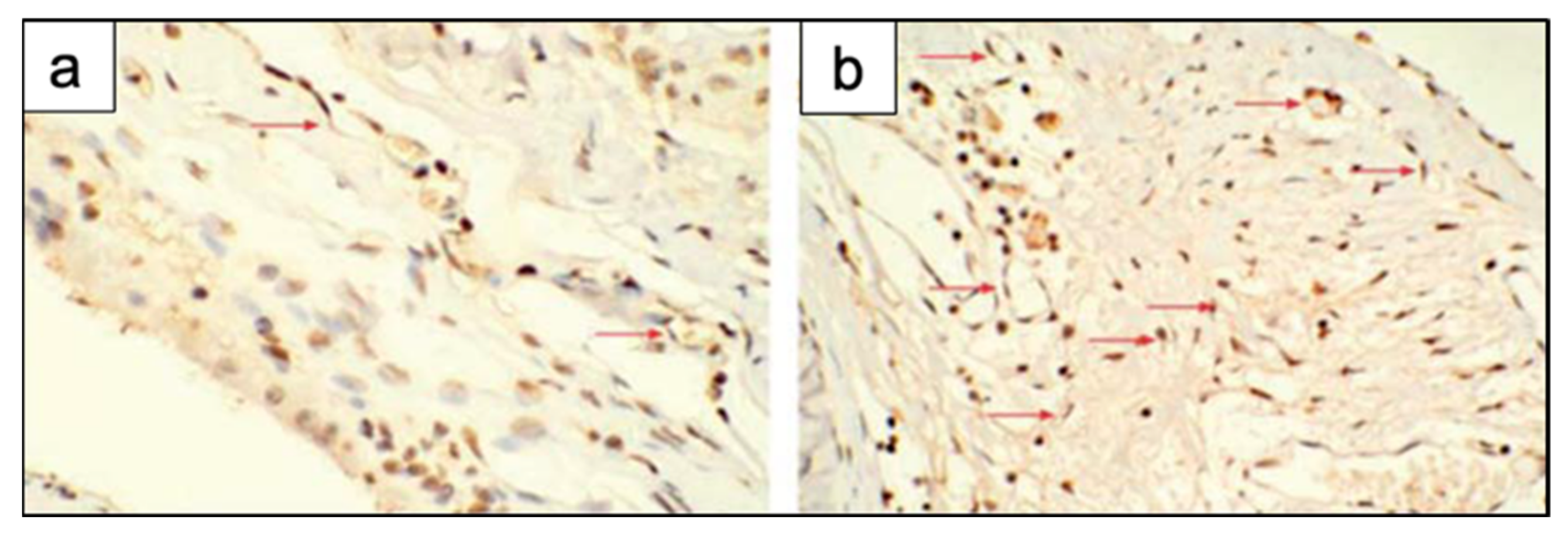 Materials 14 02795 g018