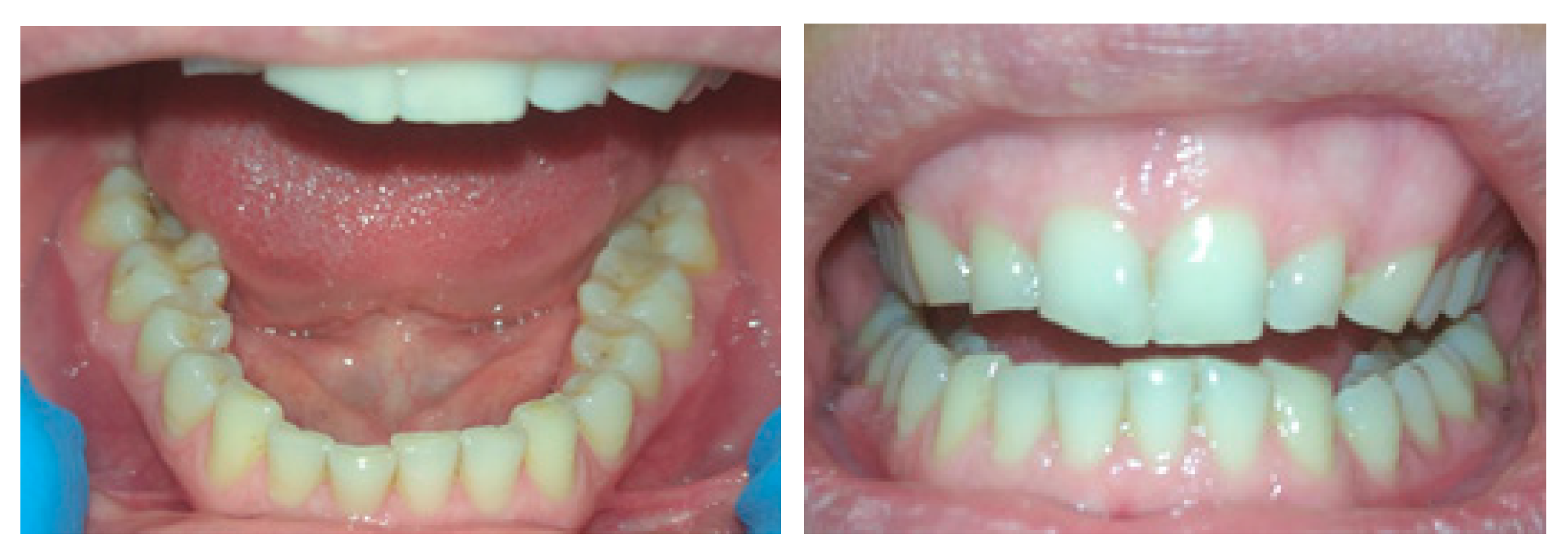 Materials 14 02925 g001