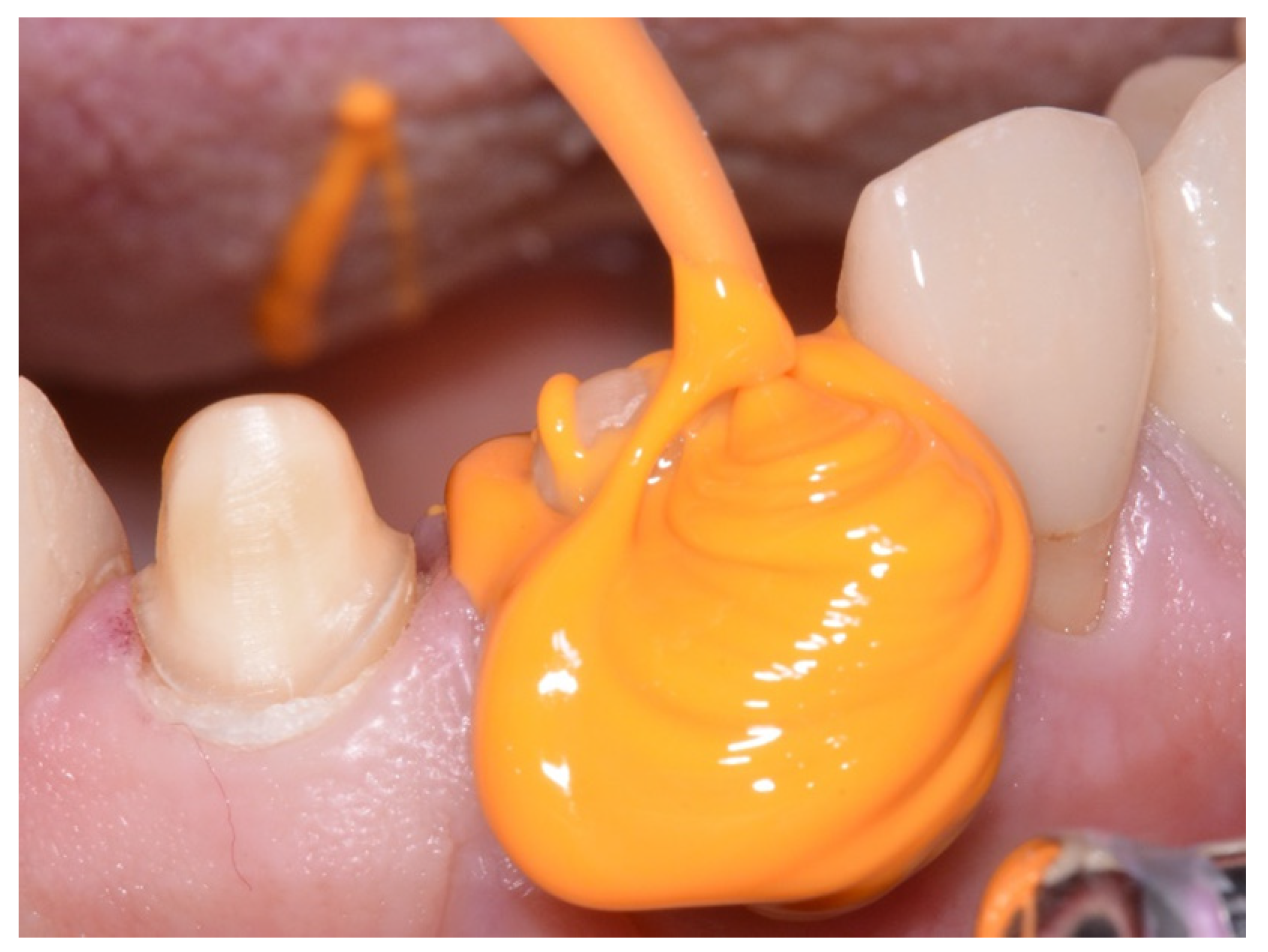 Materials 14 02994 g002