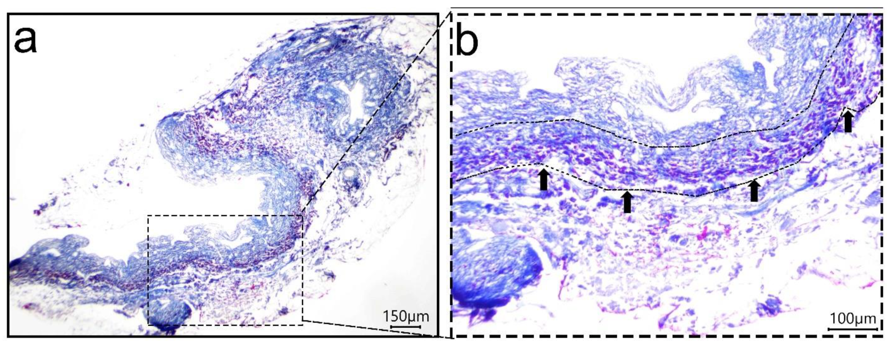 Materials 14 03099 g005