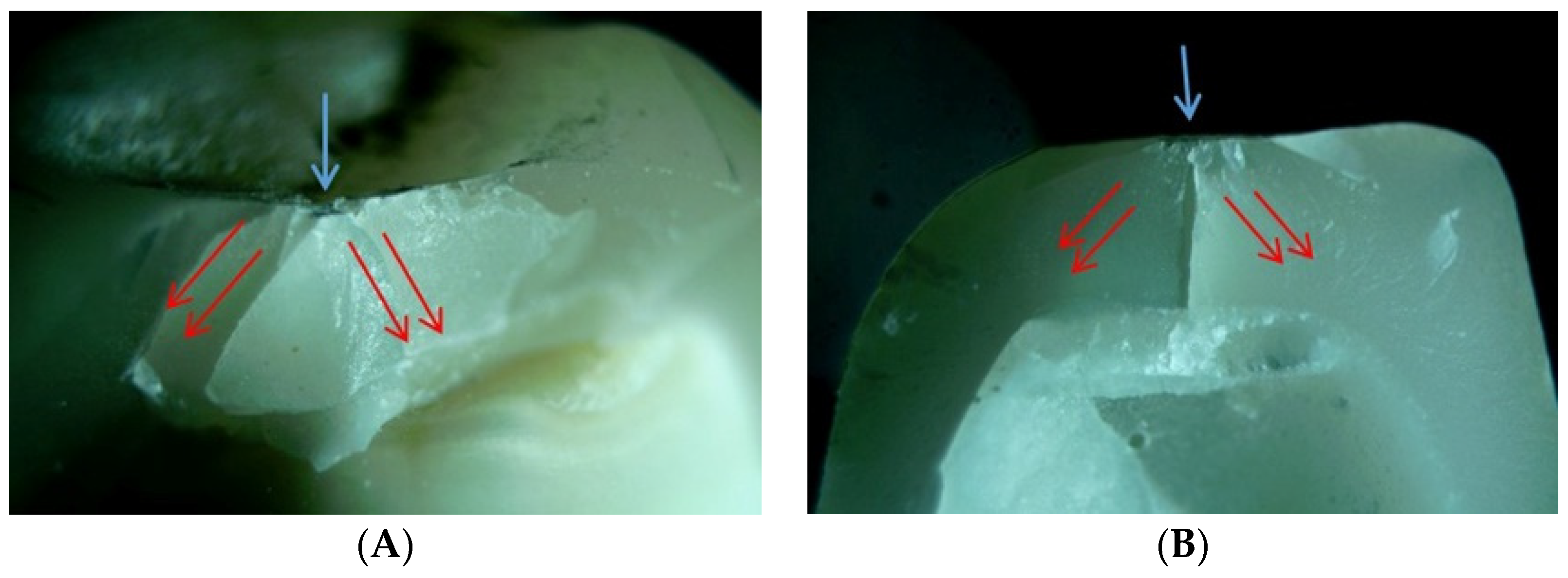 Materials 14 03115 g006a Materials 14 03115 g006a