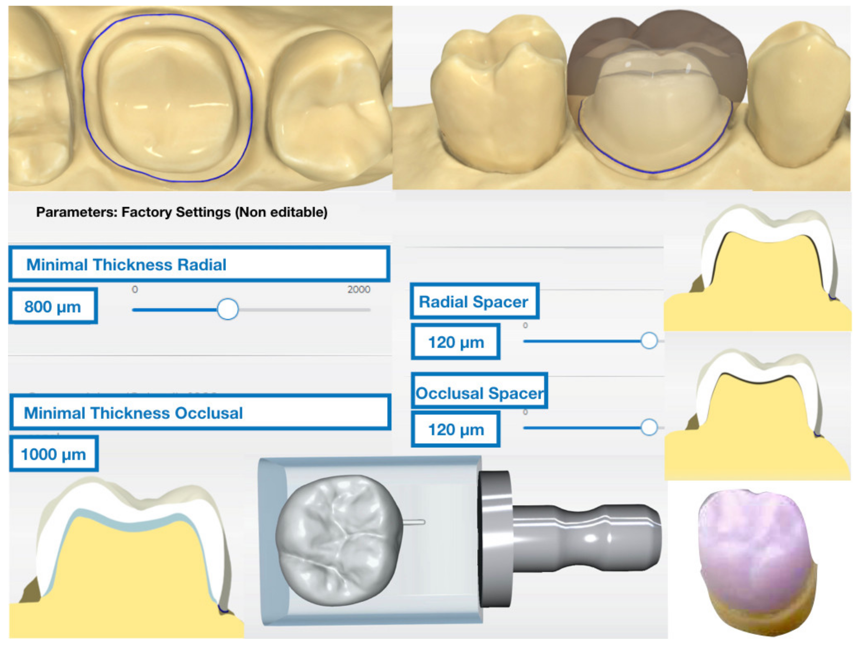 Materials 14 03215 g001