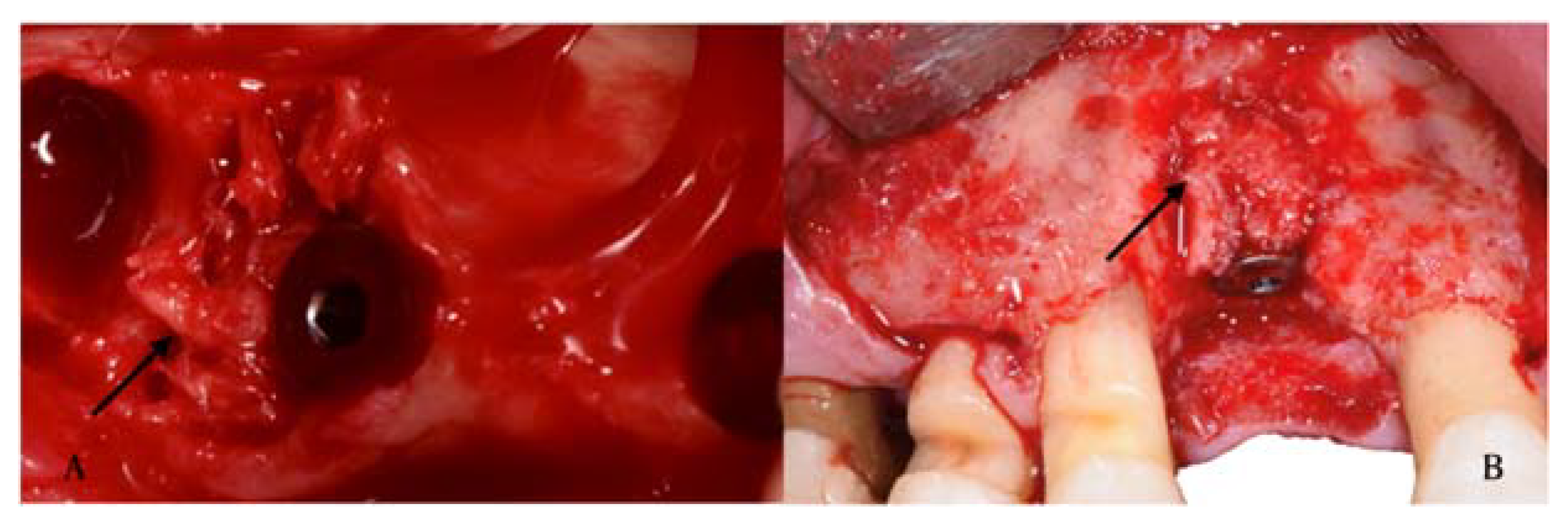 Materials 14 03319 g004 Materials 14 03319 g004