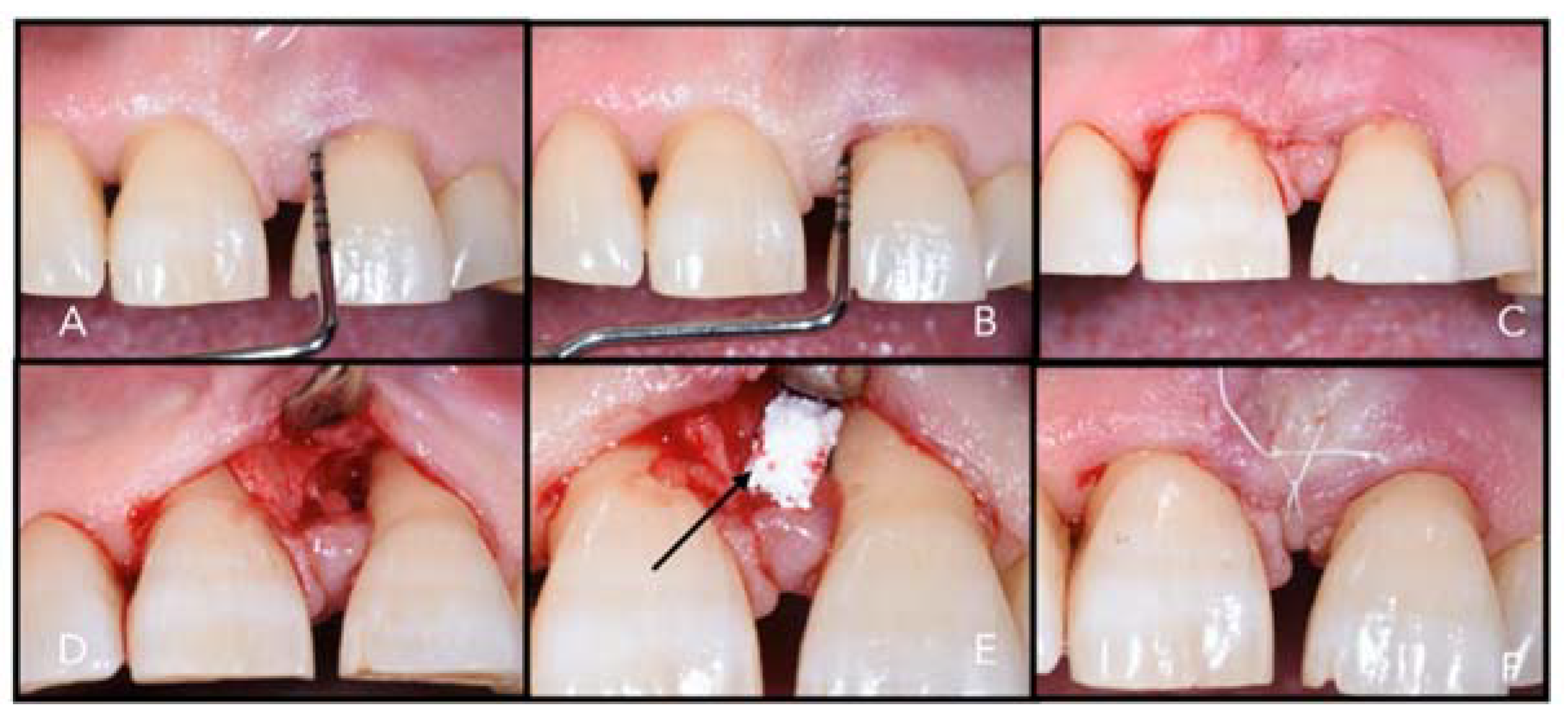 Materials 14 03319 g005 Materials 14 03319 g005